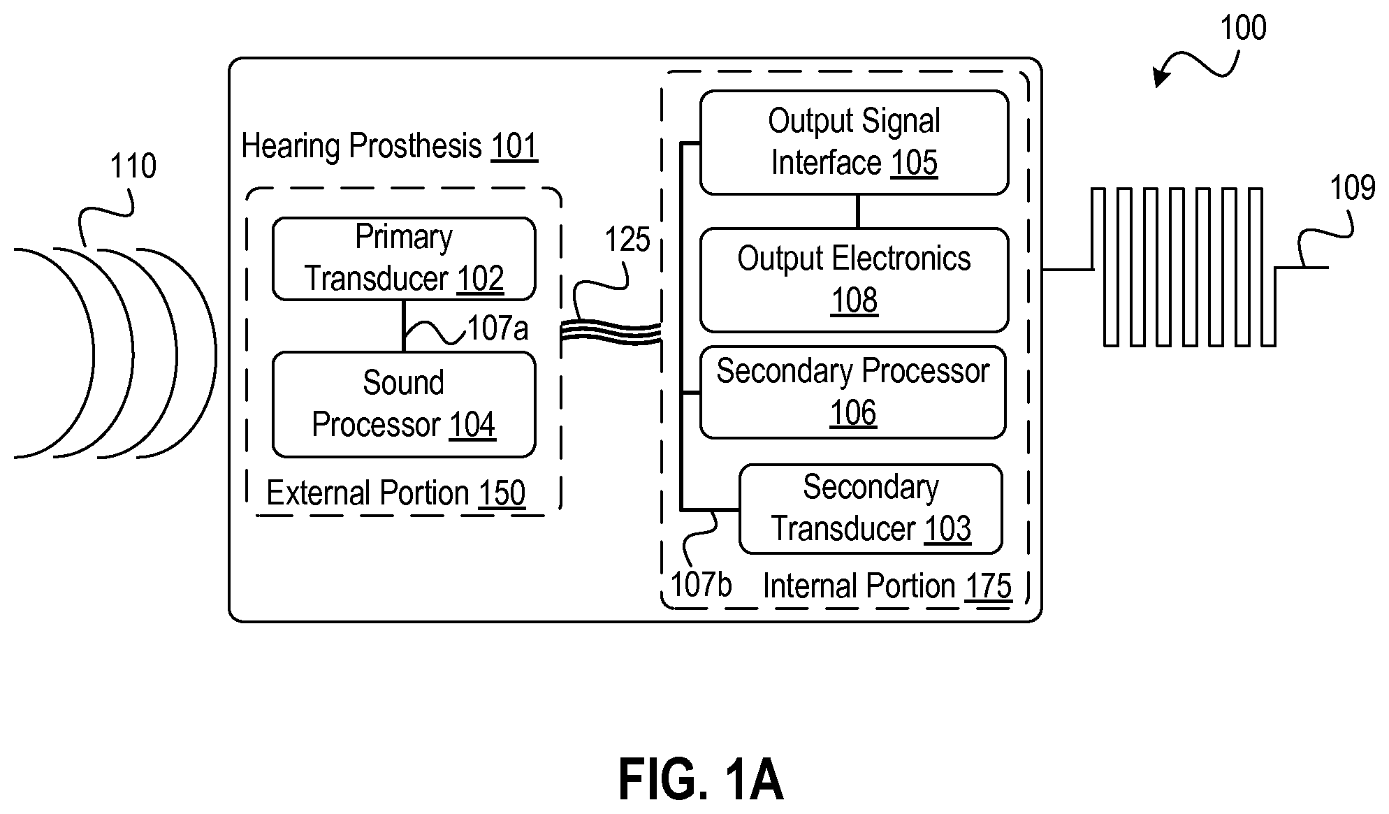 Patent US12348934 Figure 1 – Sound awareness hearing prosthesis