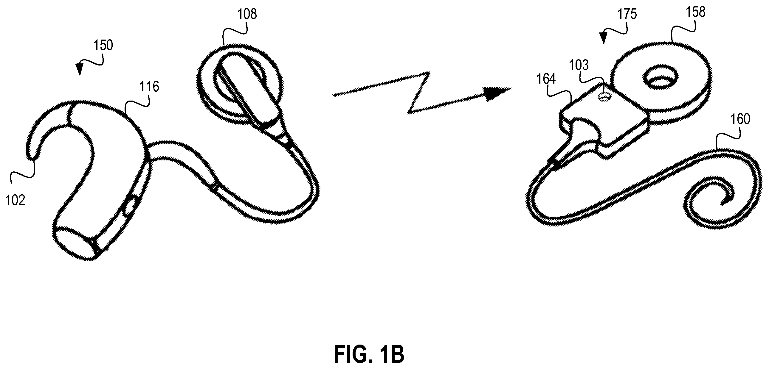 Patent US12348934 Figure 2 – Sound awareness hearing prosthesis