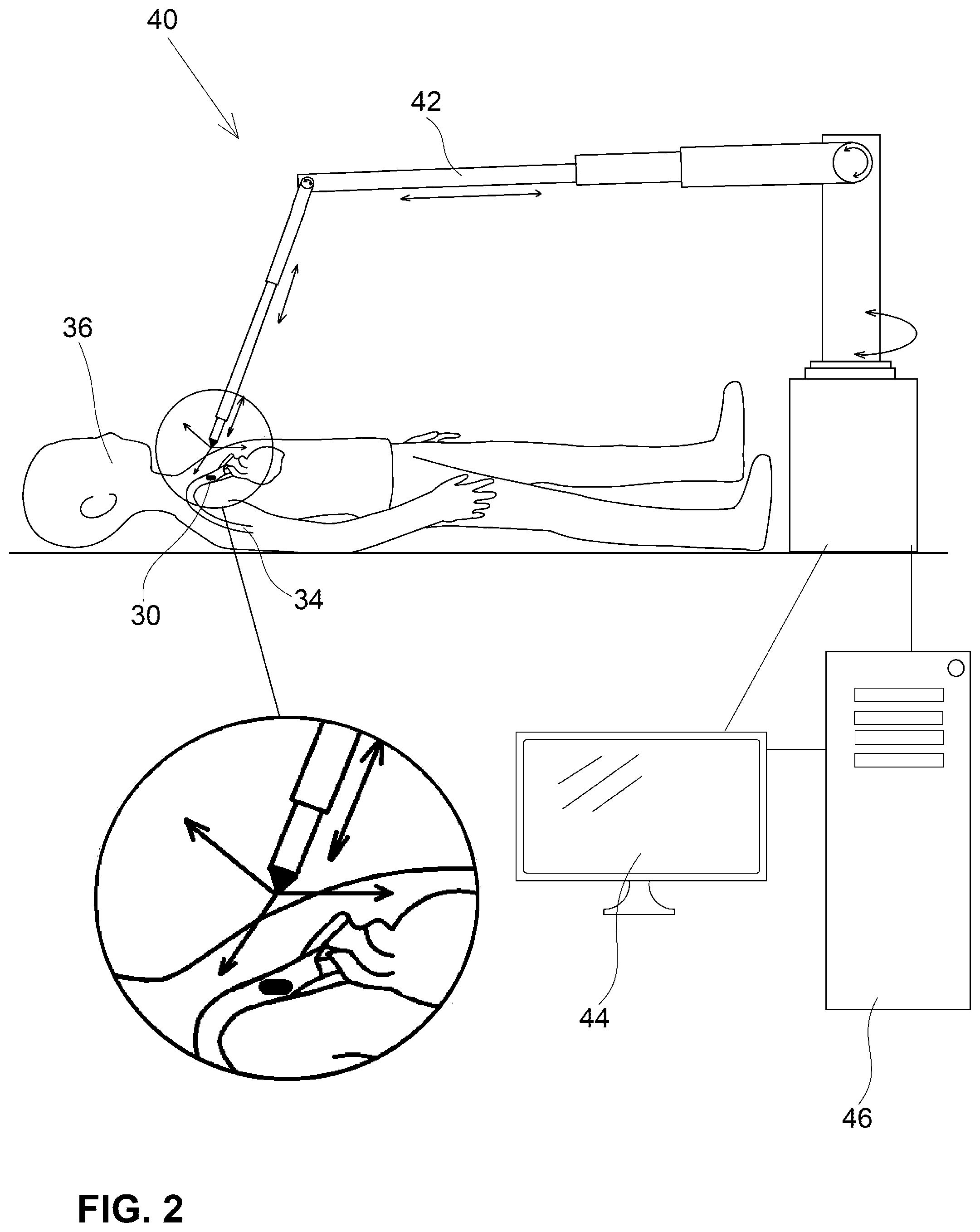 Patent US12350001 Figure 2 – System and method for catheterization using an intraluminal electromagnetic working capsule