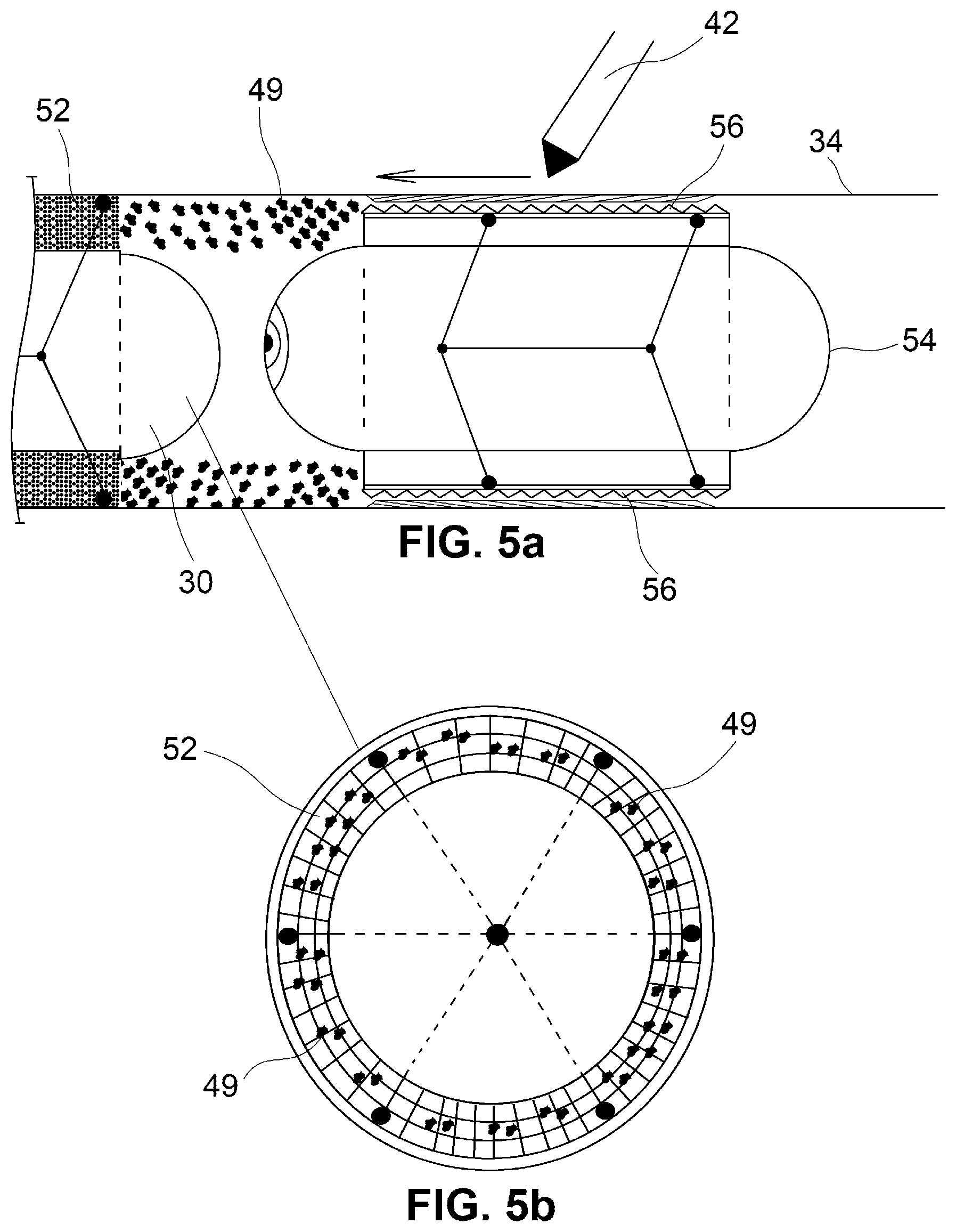 Patent US12350001 Figure 5 – System and method for catheterization using an intraluminal electromagnetic working capsule