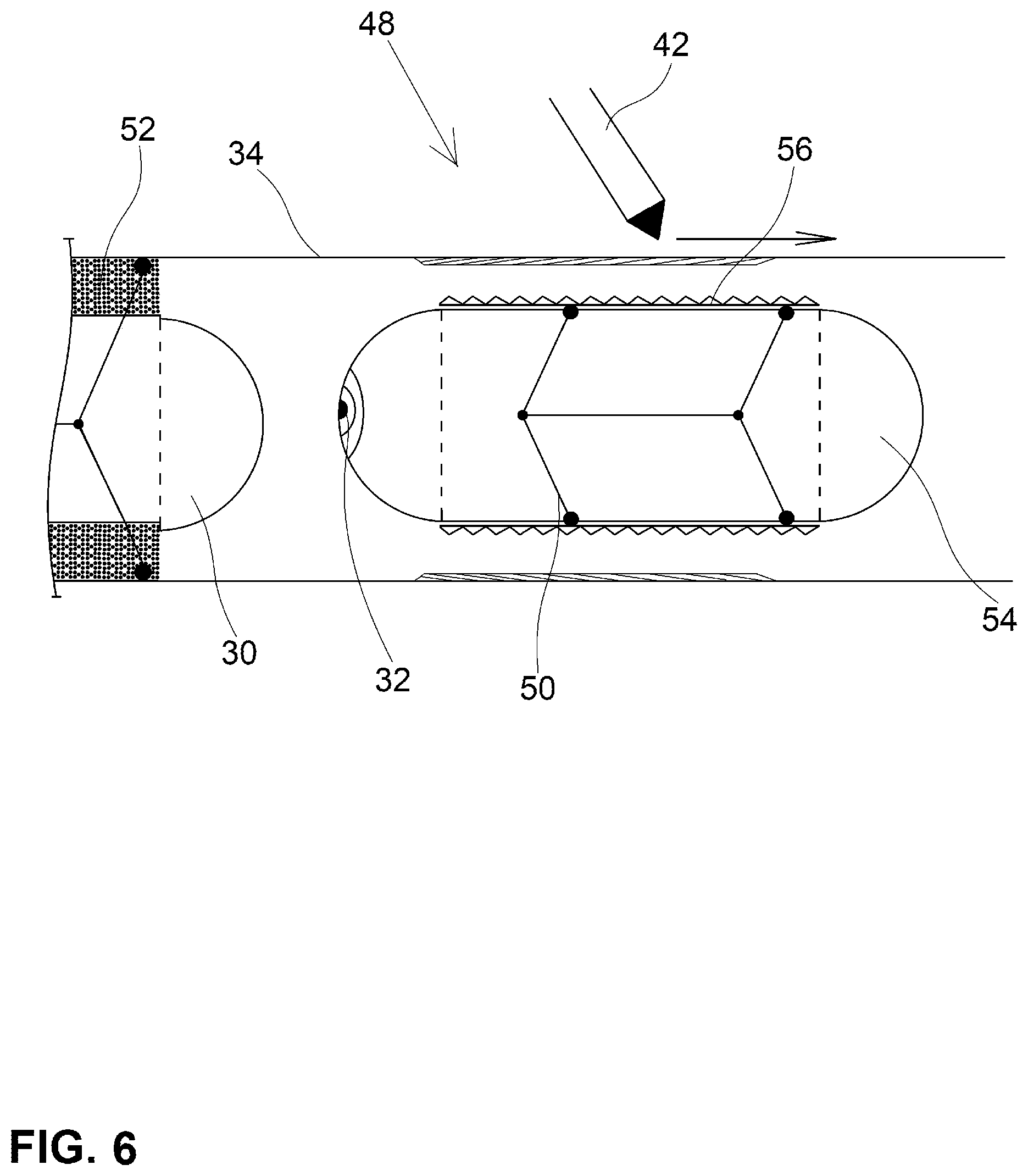 Patent US12350001 Figure 6 – System and method for catheterization using an intraluminal electromagnetic working capsule