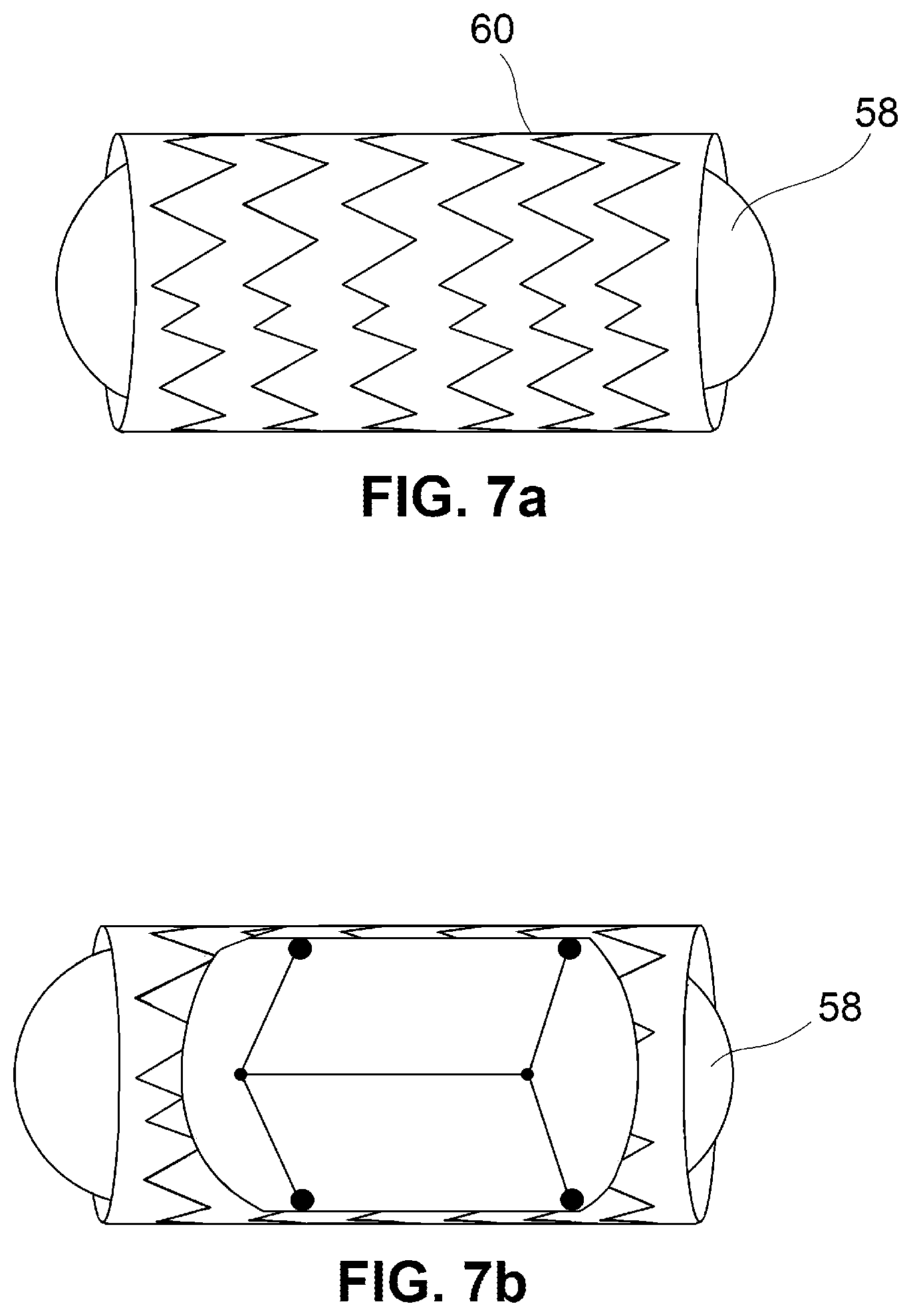 Patent US12350001 Figure 7 – System and method for catheterization using an intraluminal electromagnetic working capsule