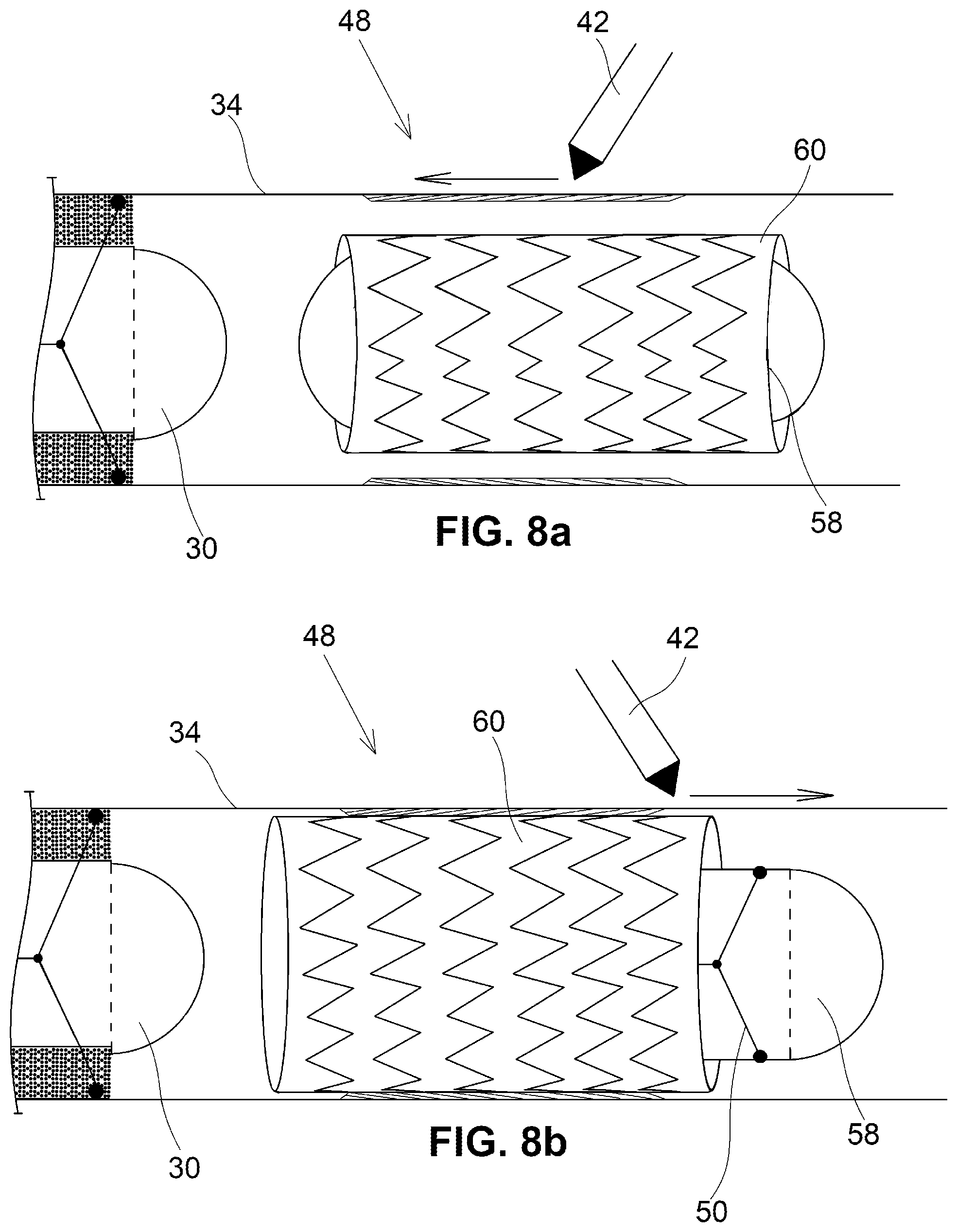 Patent US12350001 Figure 8 – System and method for catheterization using an intraluminal electromagnetic working capsule