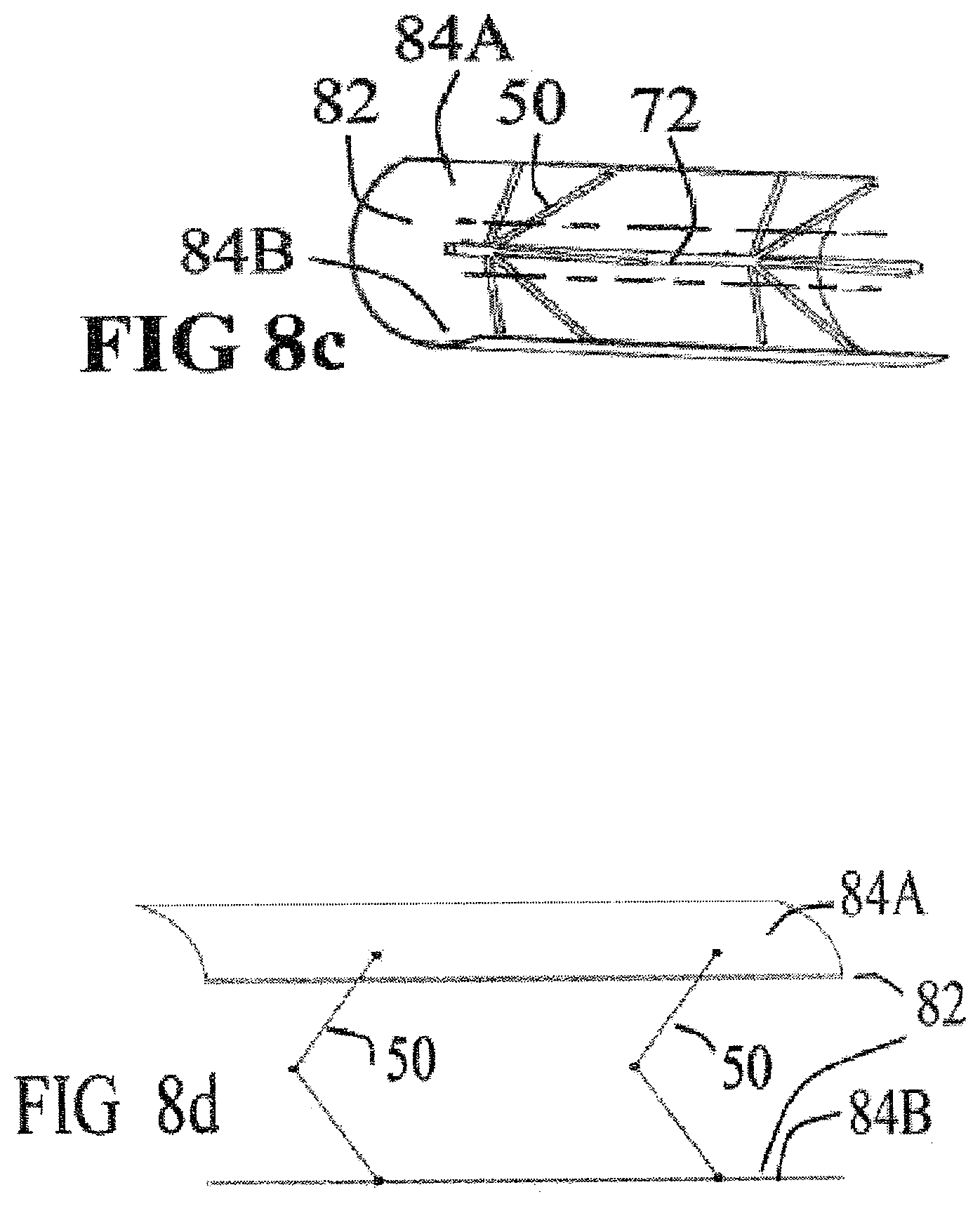 Patent US12350001 Figure 9 – System and method for catheterization using an intraluminal electromagnetic working capsule