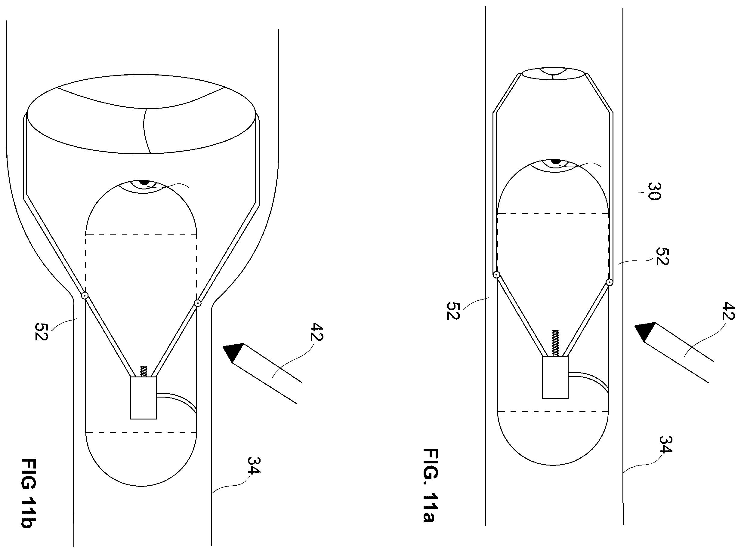 Patent US12350001 Figure 12 – System and method for catheterization using an intraluminal electromagnetic working capsule