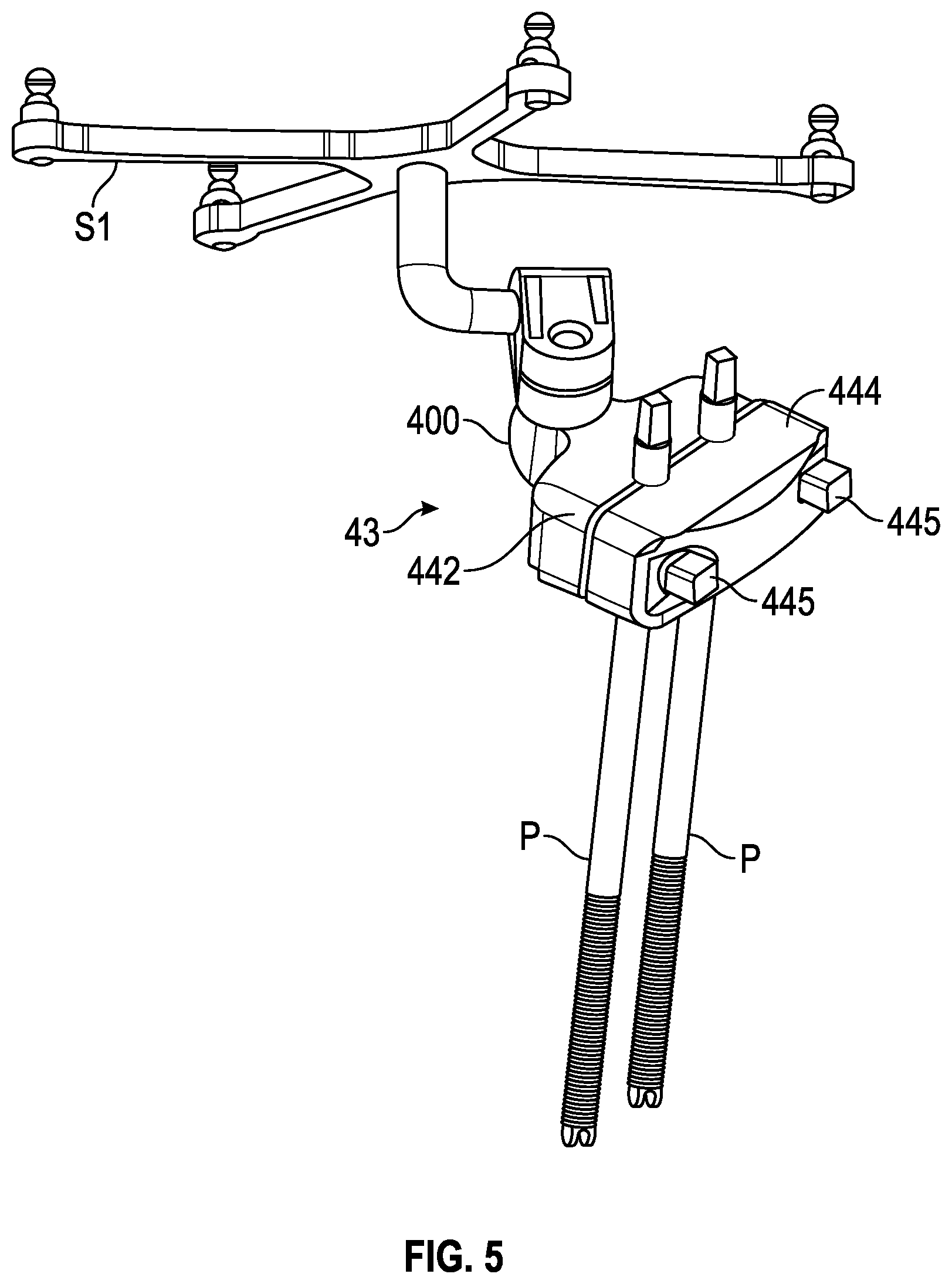 Patent US12350002 Figure 4 – Soft tissue cutting instrument and method of use