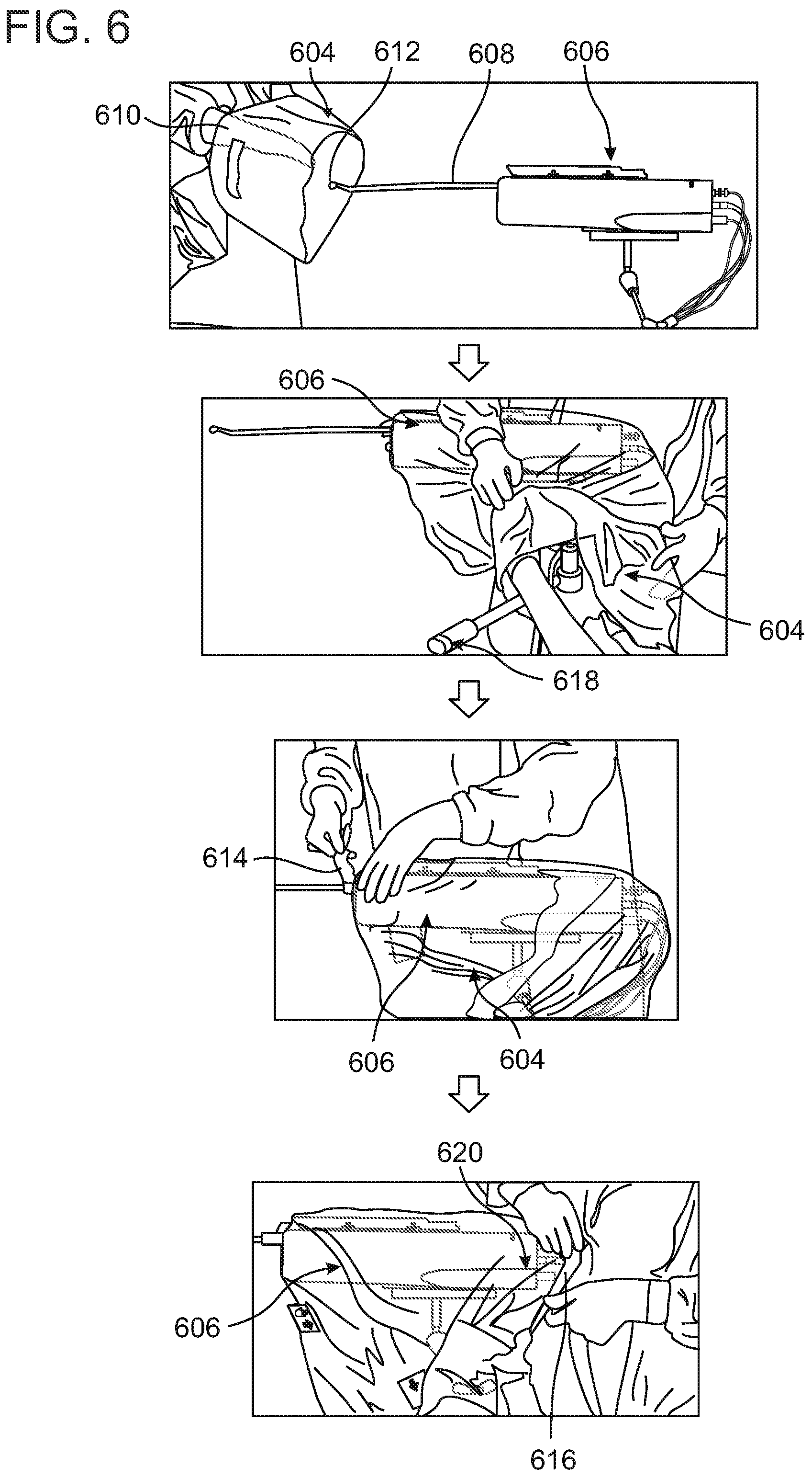 Patent US12350003 Figure 7 – Surgical drape