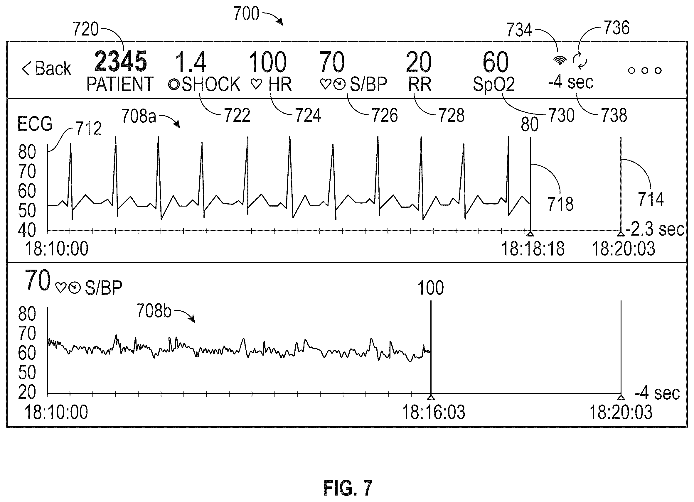 Patent US12350007 Figure 7 – Wearable health monitoring device