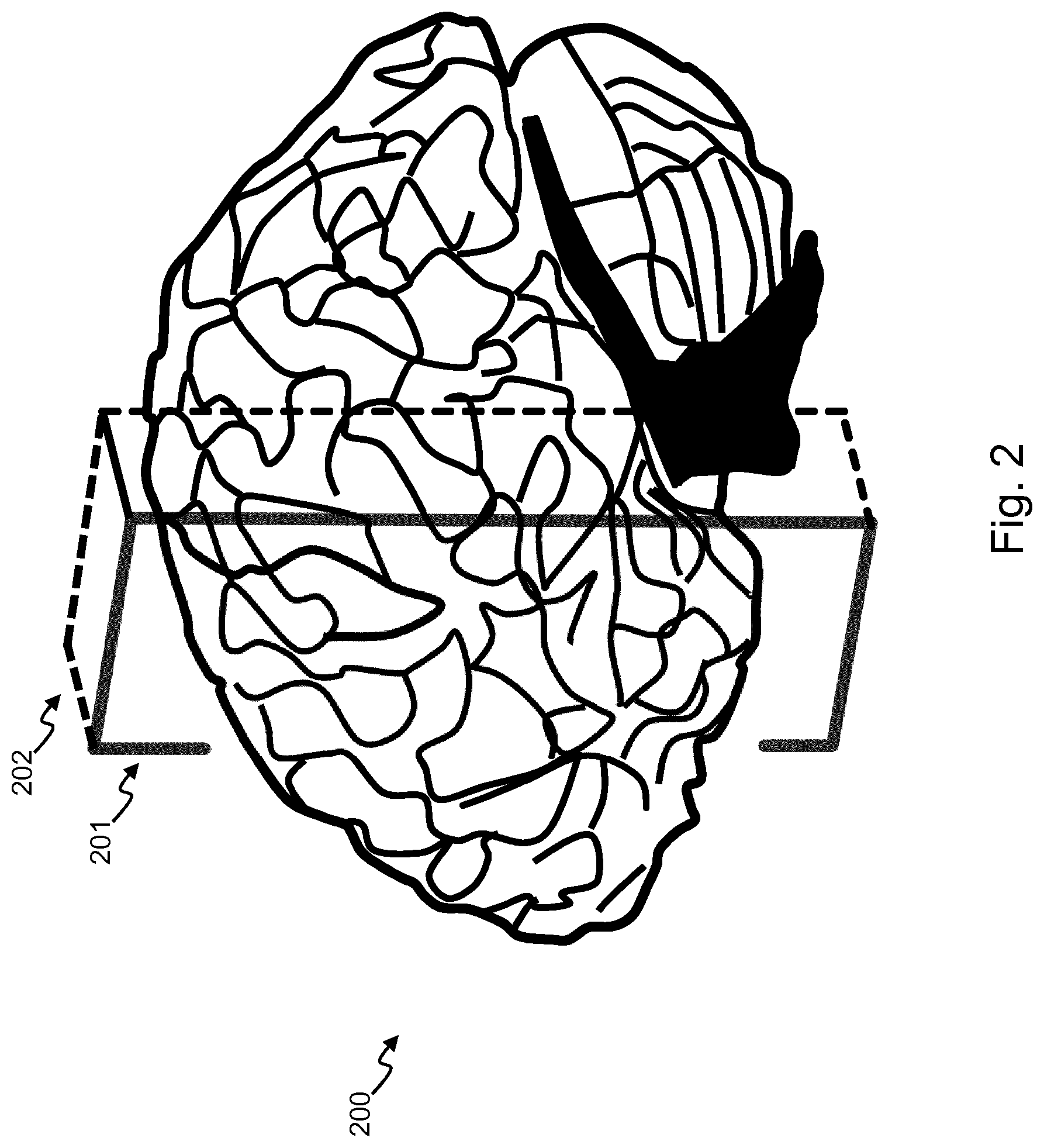Patent US12350008 Figure 2 – Determination of parametrized characteristics of a tissue
