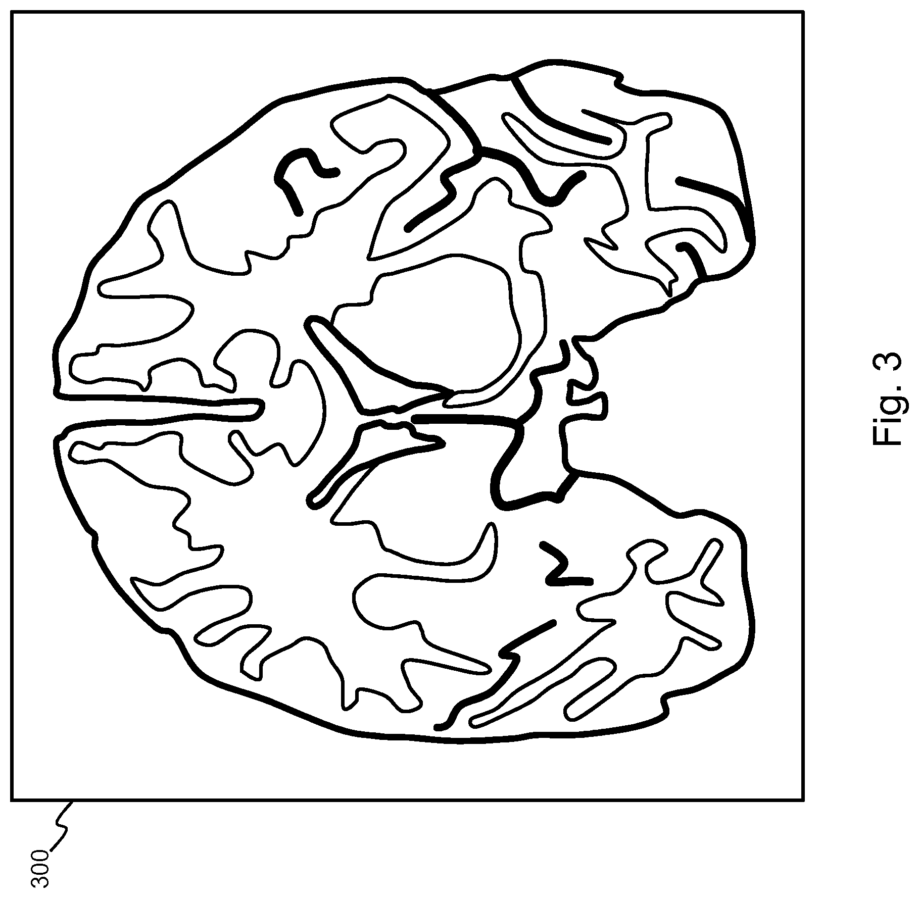 Patent US12350008 Figure 3 – Determination of parametrized characteristics of a tissue