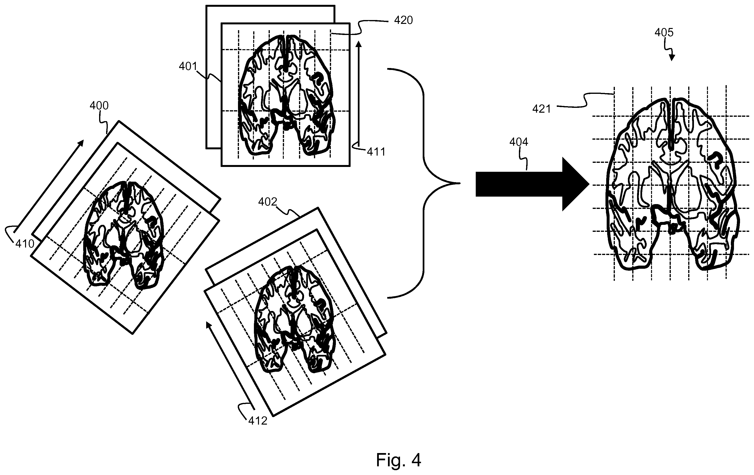 Patent US12350008 Figure 4 – Determination of parametrized characteristics of a tissue