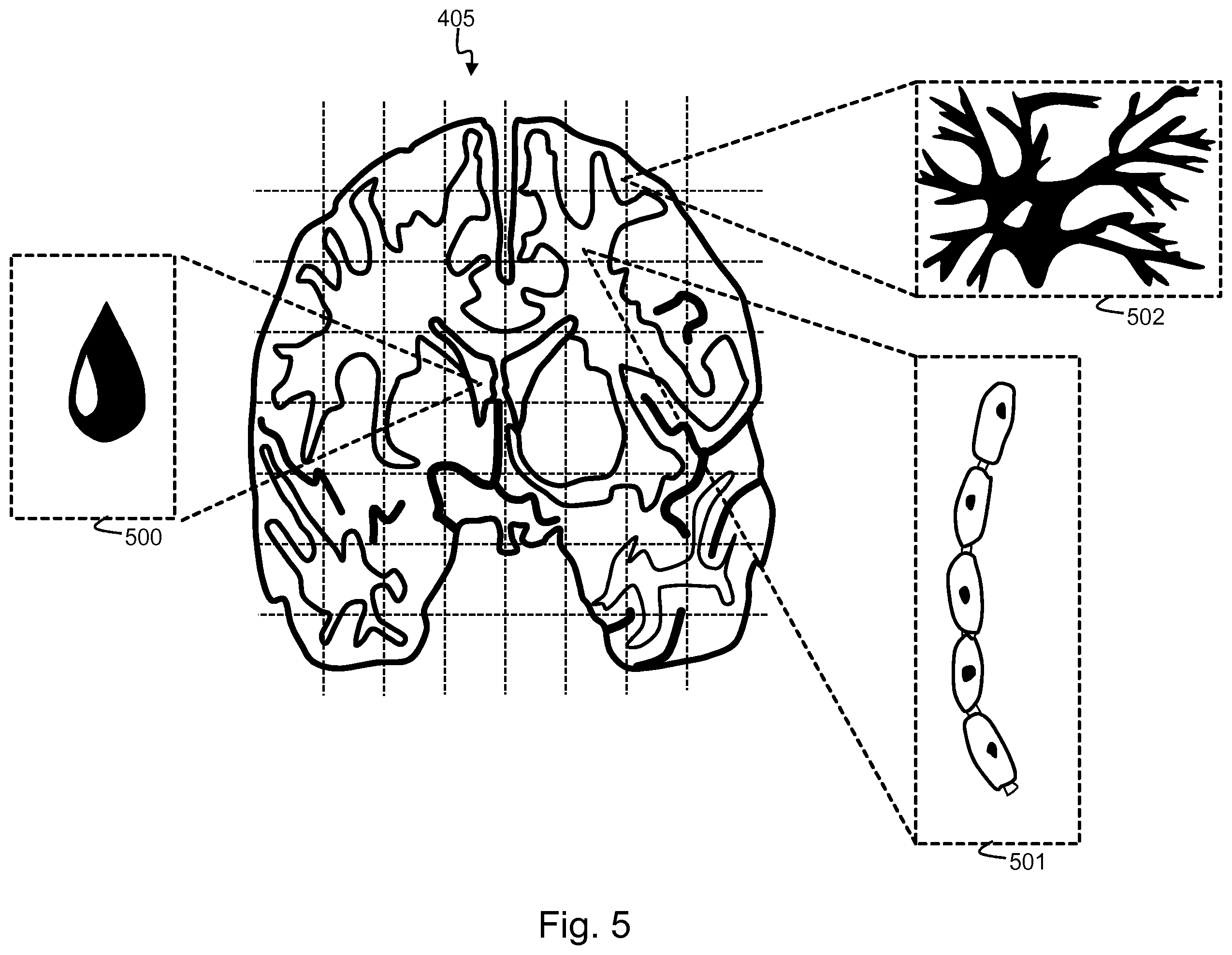 Patent US12350008 Figure 5 – Determination of parametrized characteristics of a tissue