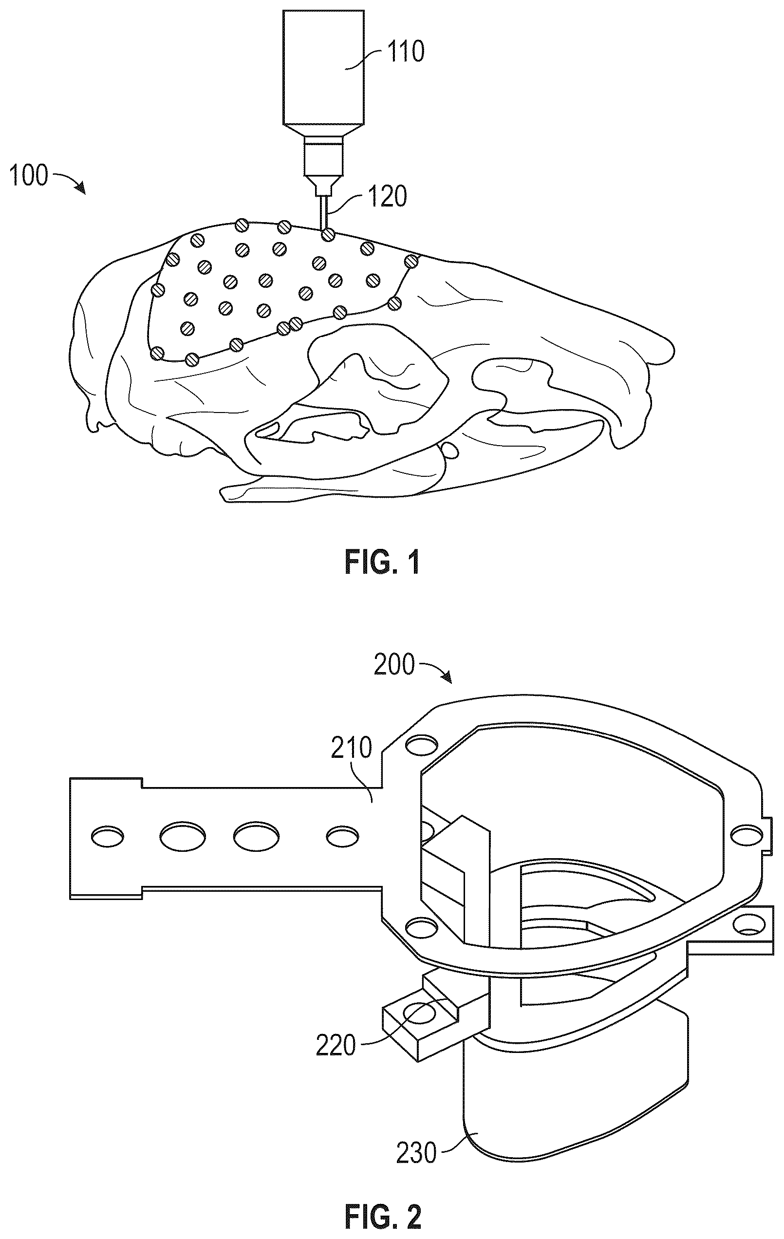 Patent US12350010 Figure 1 – Systems and methods for multimodal neural sensing