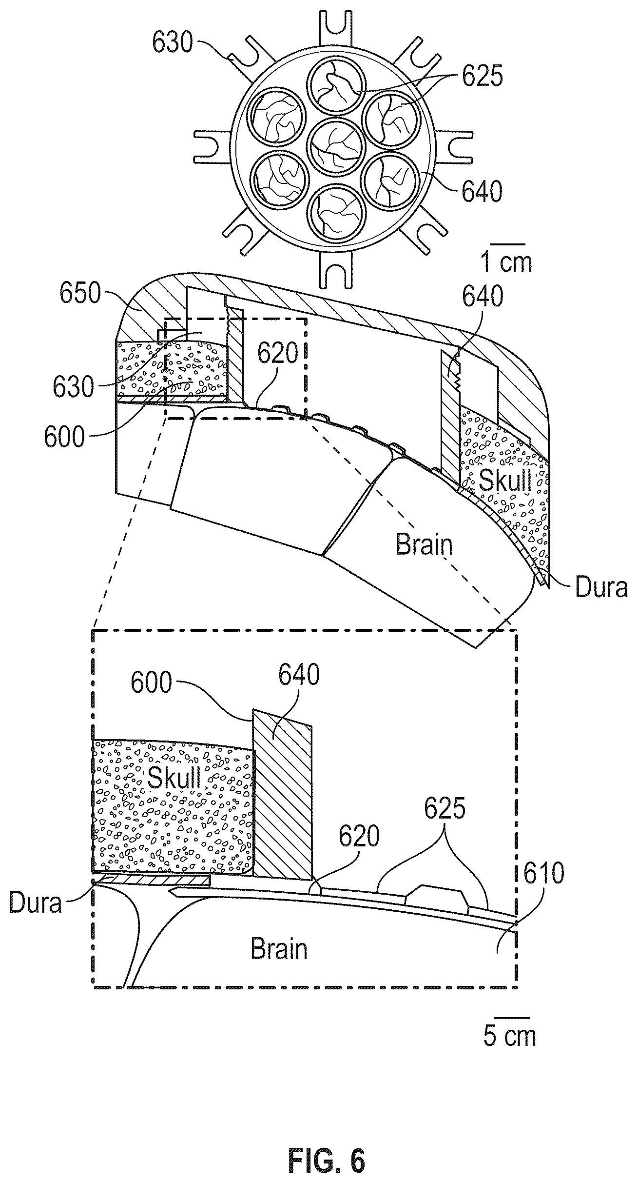 Patent US12350010 Figure 6 – Systems and methods for multimodal neural sensing