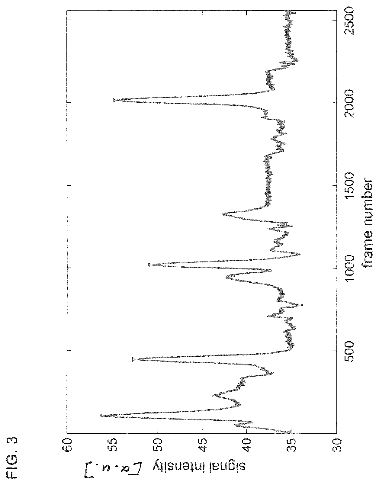 Patent US12350011 Figure 3 – Method of measuring a fluorescence signal, determining a peak frequency map and providing a risk prediction value, image capturing and processing device