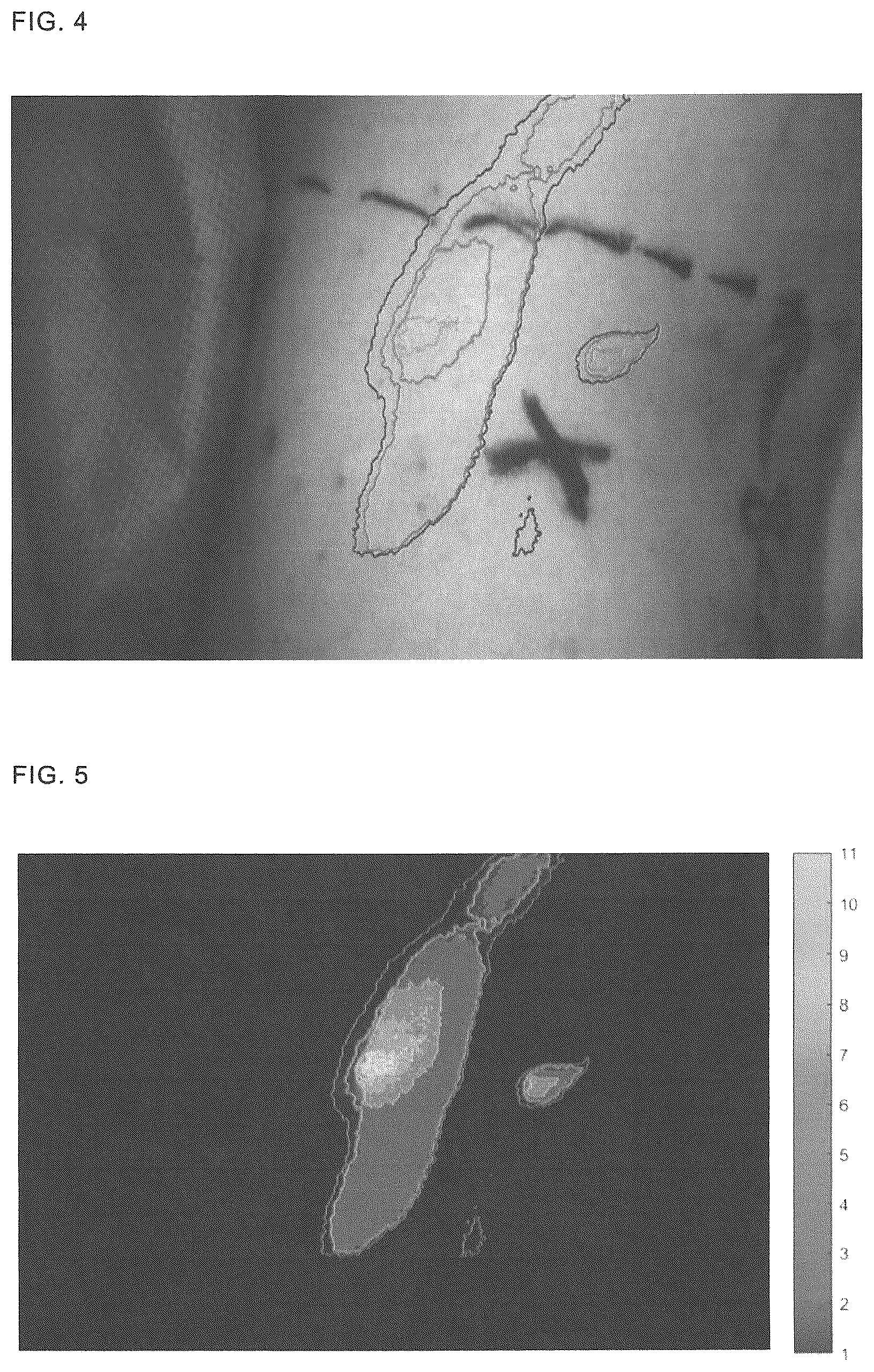 Patent US12350011 Figure 4 – Method of measuring a fluorescence signal, determining a peak frequency map and providing a risk prediction value, image capturing and processing device