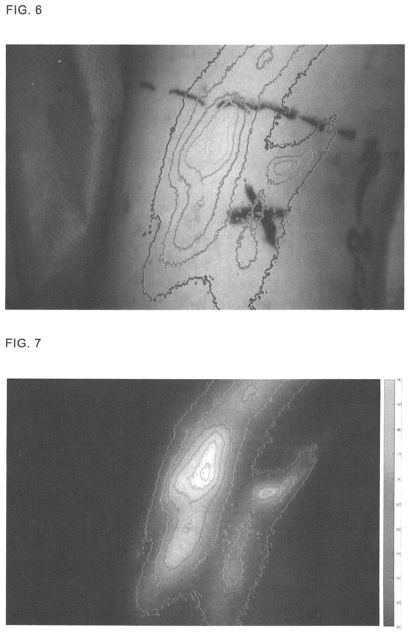 Patent US12350011 Figure 5 – Method of measuring a fluorescence signal, determining a peak frequency map and providing a risk prediction value, image capturing and processing device