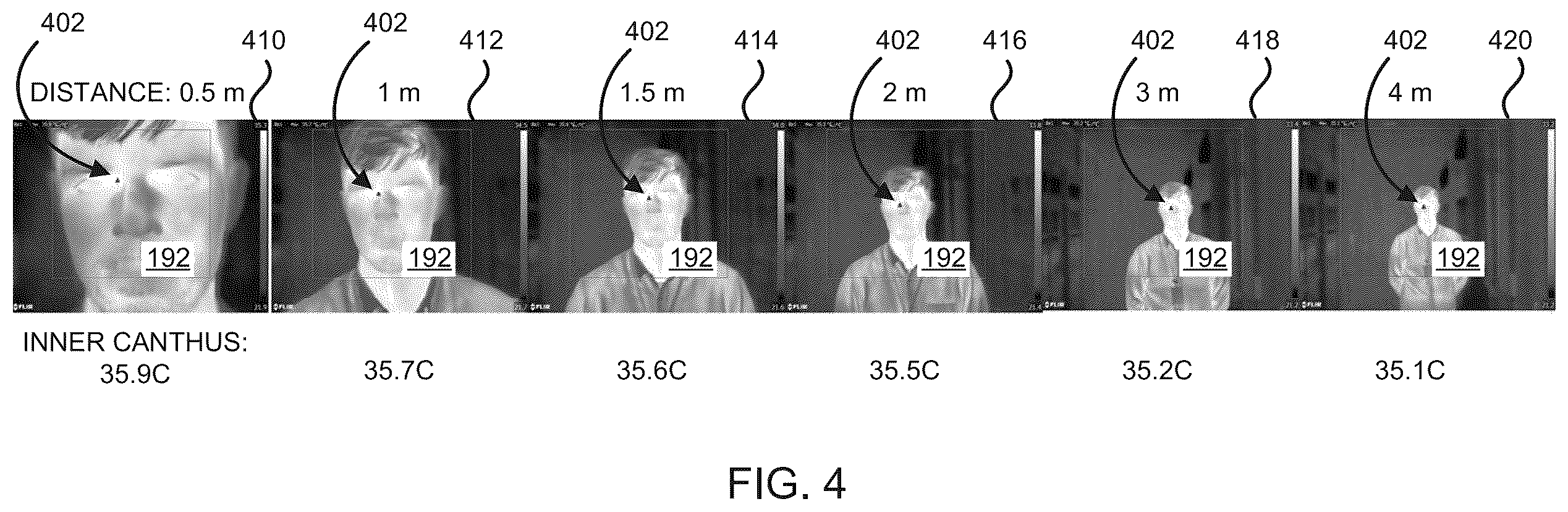 Patent US12350016 Figure 4 – Thermal imaging temperature measurement of inner canthus systems and methods