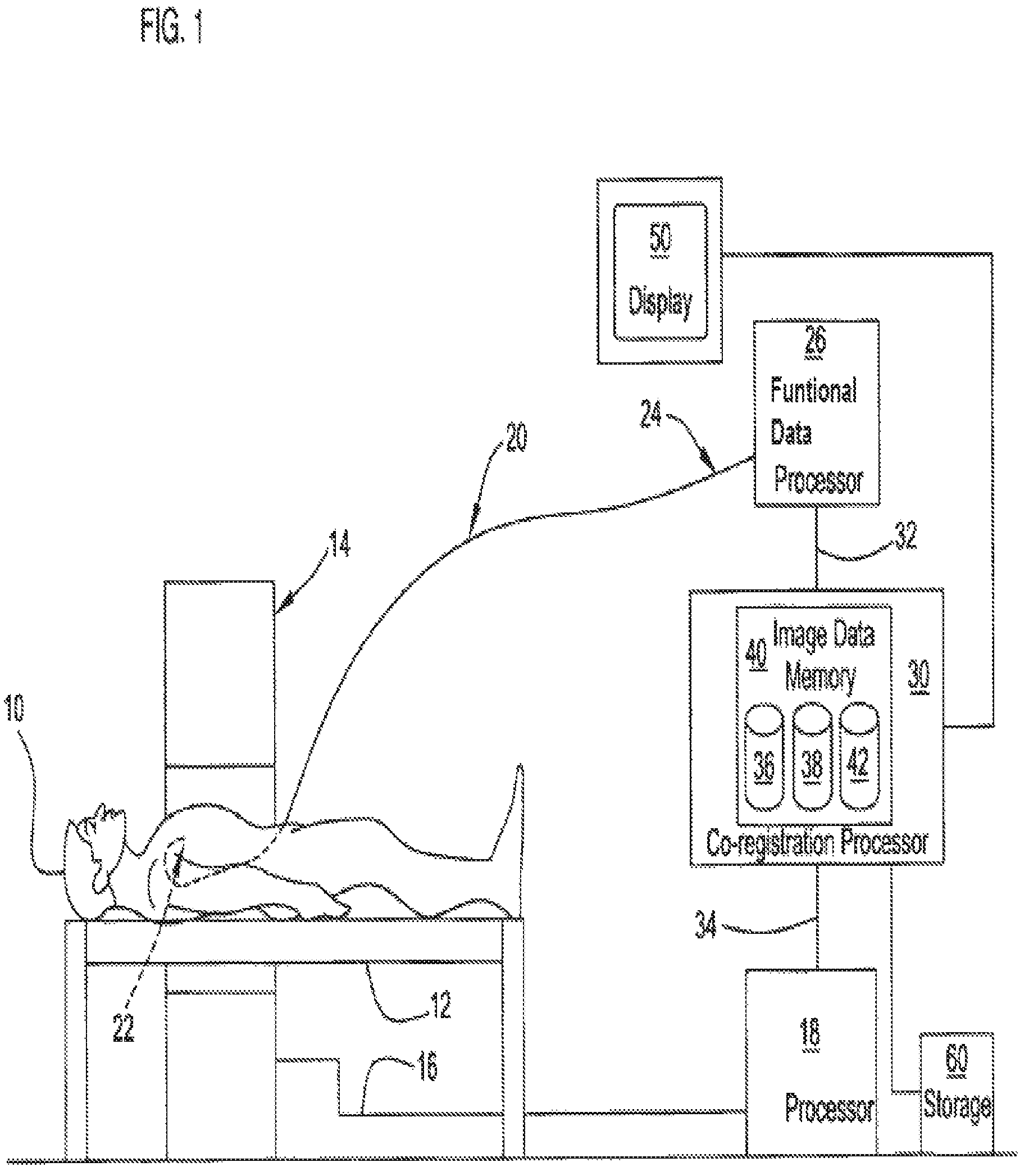 Patent US12350018 Figure 1 – Systems and methods for diagnosing coronary microvascular disease