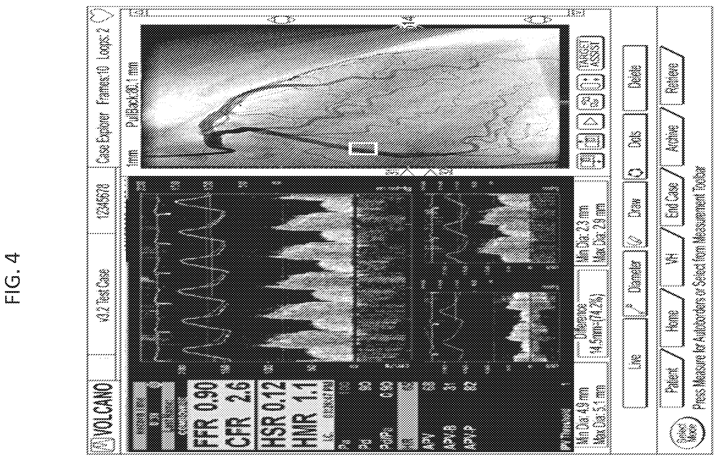 Patent US12350018 Figure 3 – Systems and methods for diagnosing coronary microvascular disease