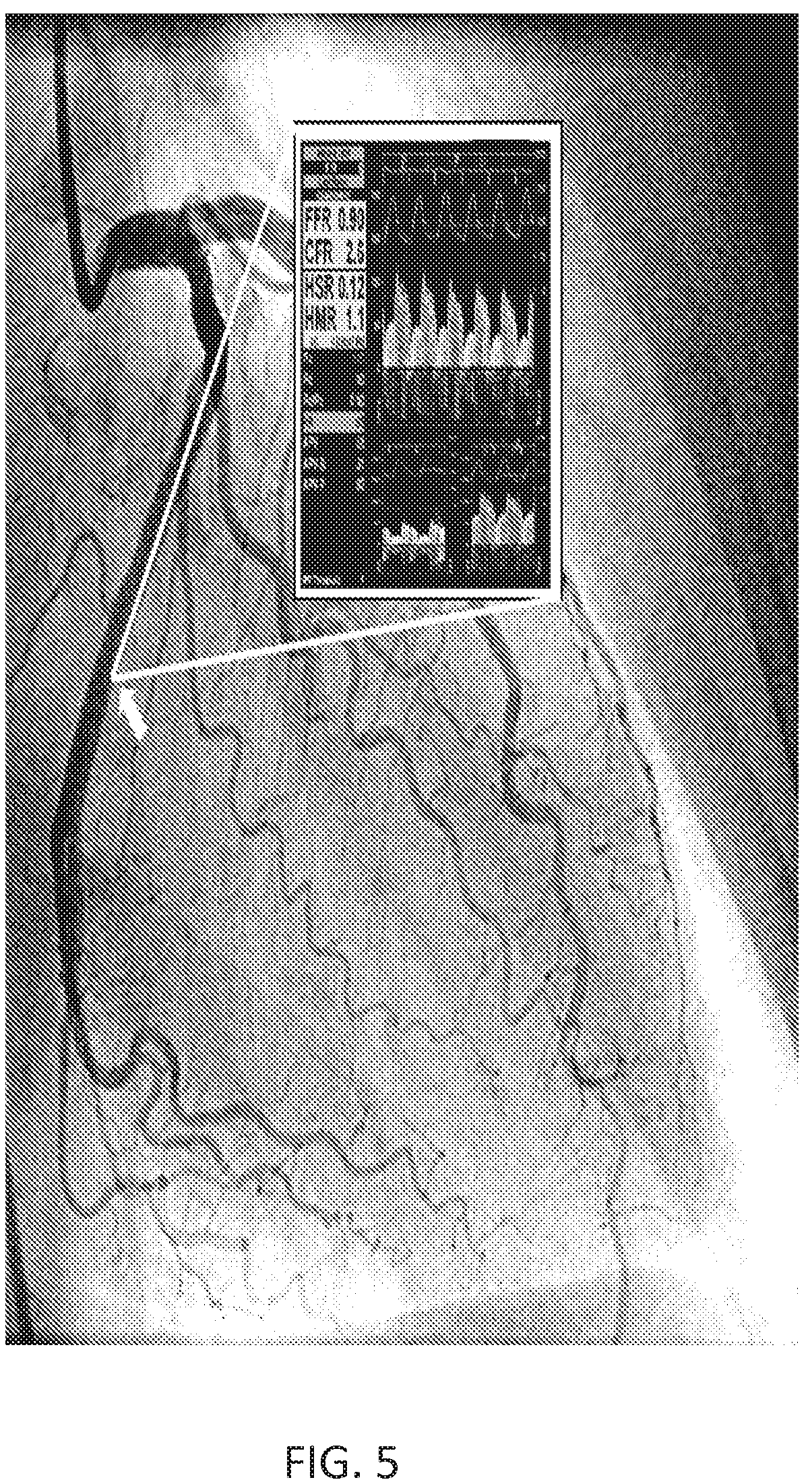 Patent US12350018 Figure 4 – Systems and methods for diagnosing coronary microvascular disease