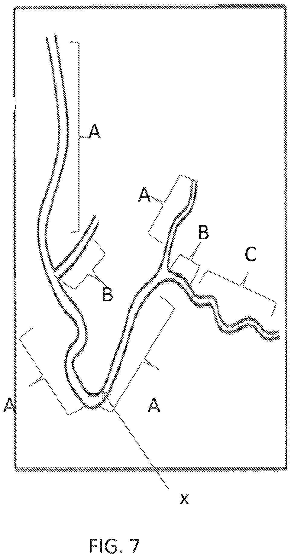 Patent US12350018 Figure 6 – Systems and methods for diagnosing coronary microvascular disease