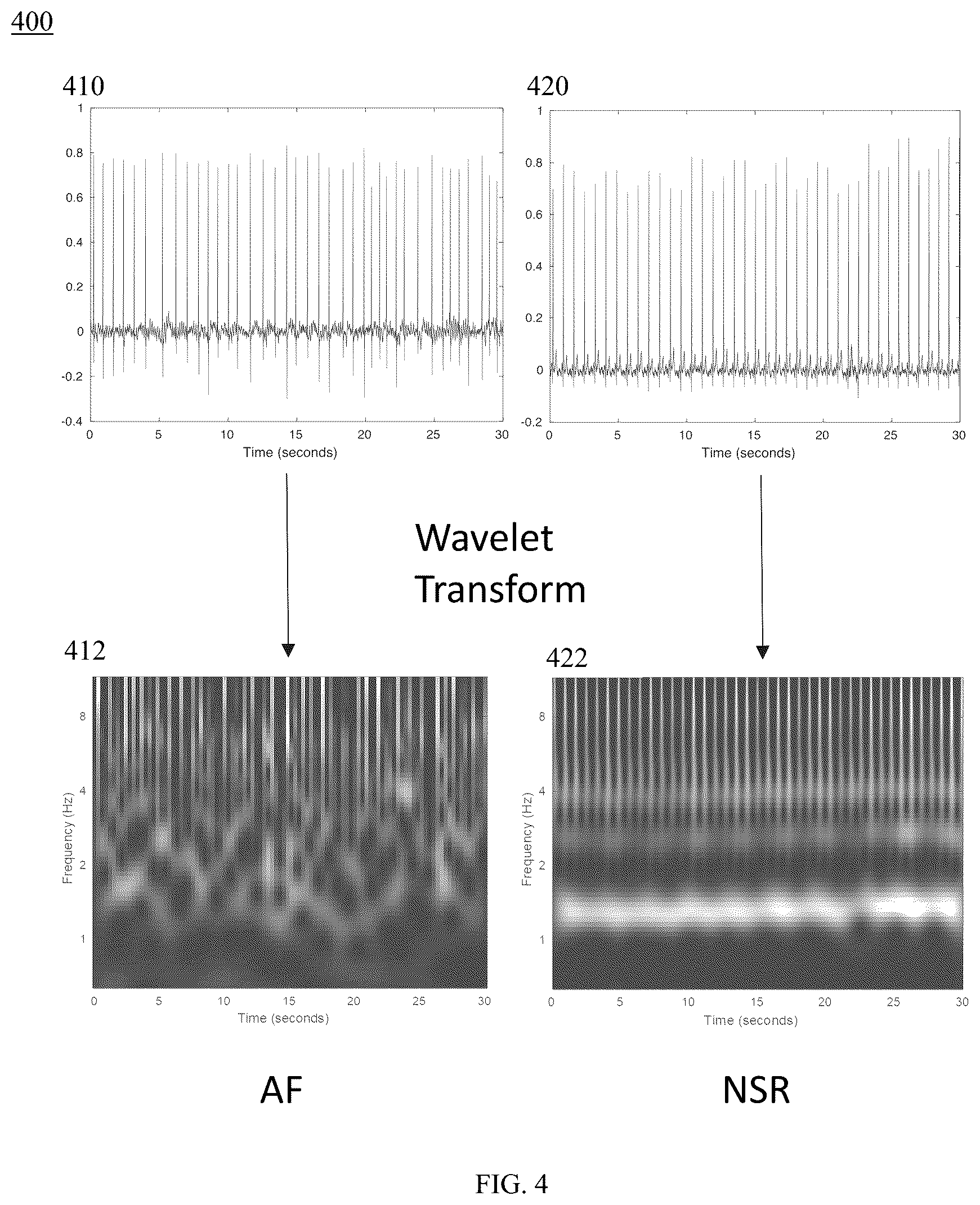 Patent US12350019 Figure 4 – Methods and systems for determining abnormal cardiac activity