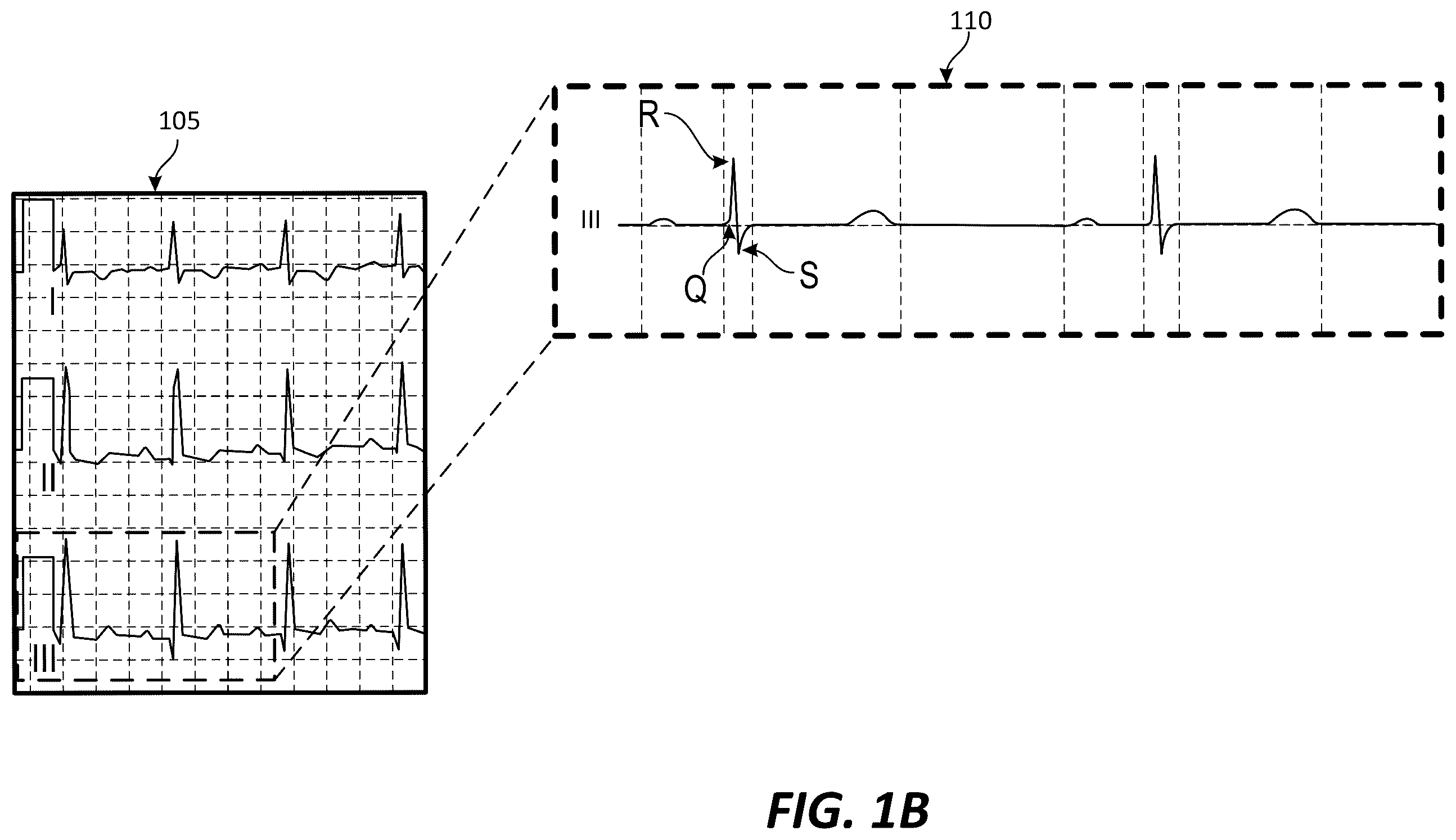 Patent US12350020 Figure 2 – Multi-parameter monitoring device