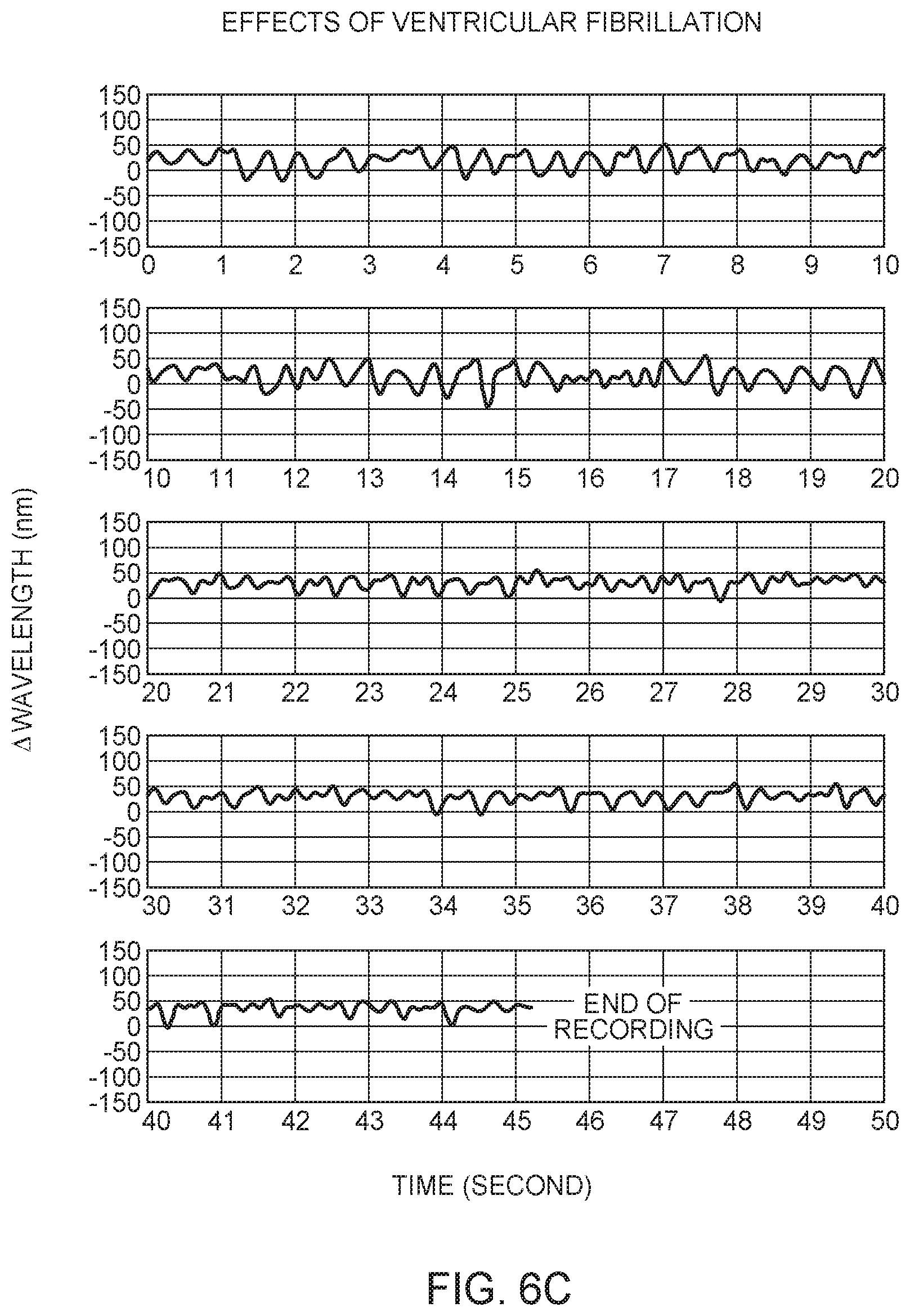Patent US12350021 Figure 7 – Non-barometric determination of hemodynamic effects of cardiac arrhythmias using signals sensed by an implantable device