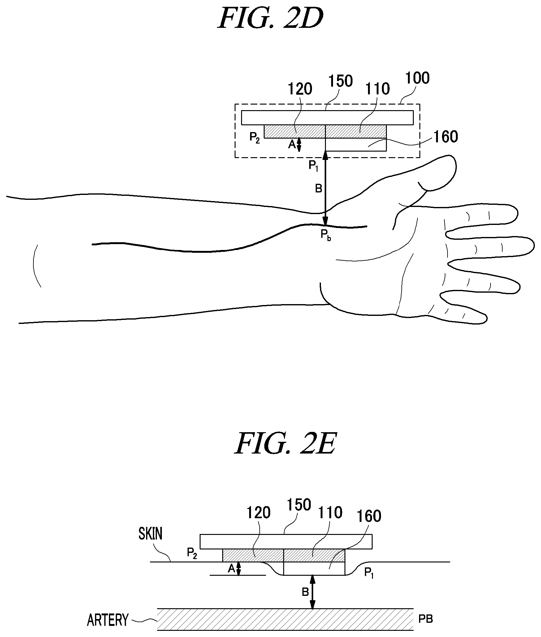 Patent US12350022 Figure 3 – Sensor module for measuring blood pressure, and wrist-wearable portable blood pressure measurement device using same
