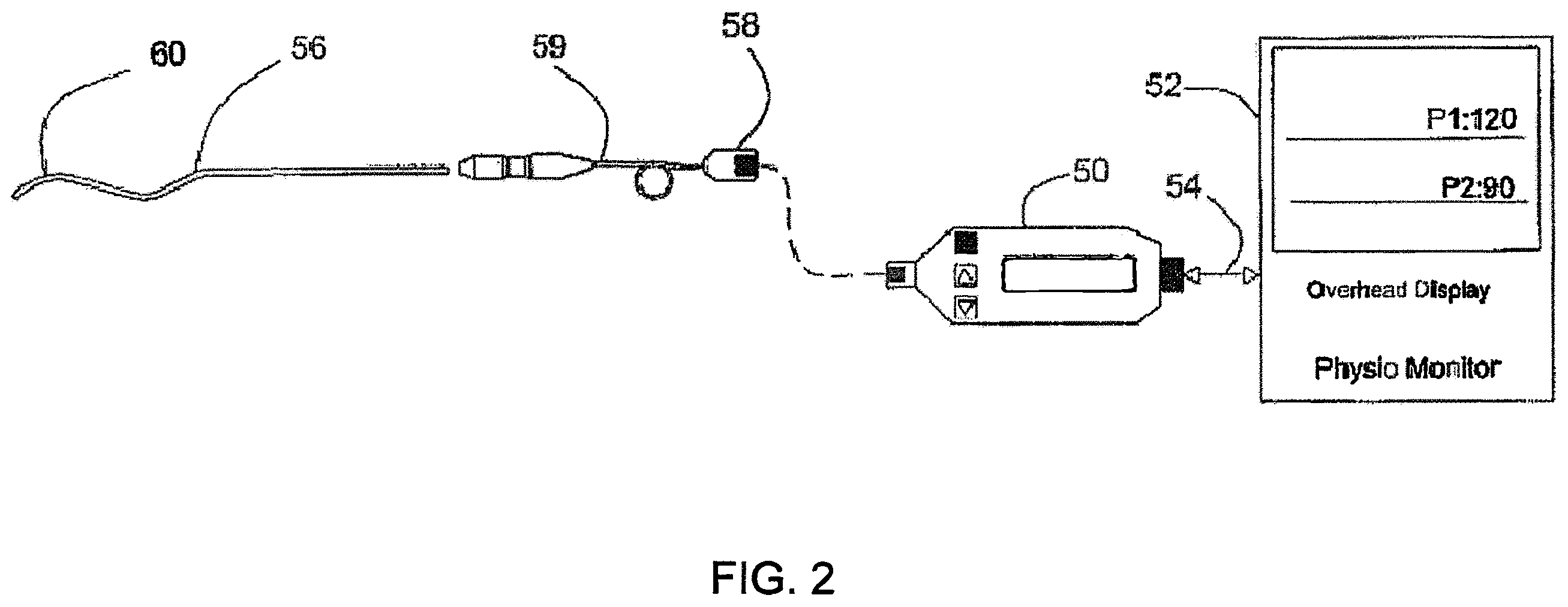 Patent US12350024 Figure 2 – Intravascular pressure devices incorporating sensors manufactured using deep reactive ion etching