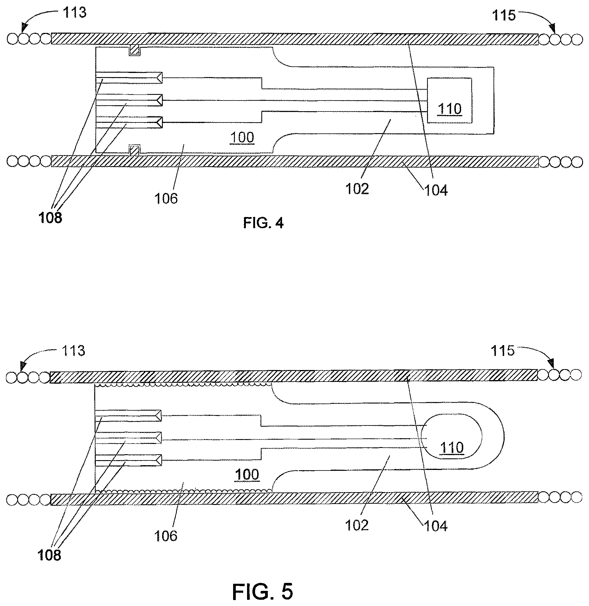 Patent US12350024 Figure 4 – Intravascular pressure devices incorporating sensors manufactured using deep reactive ion etching