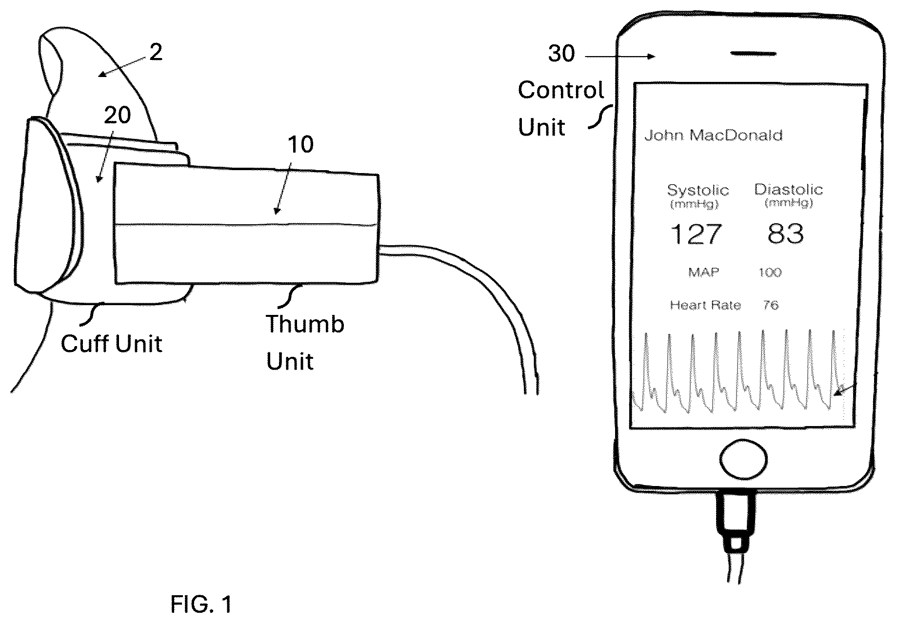 Patent US12350025 — Optical-based oscillometry blood pressure measurement device — Figure 1