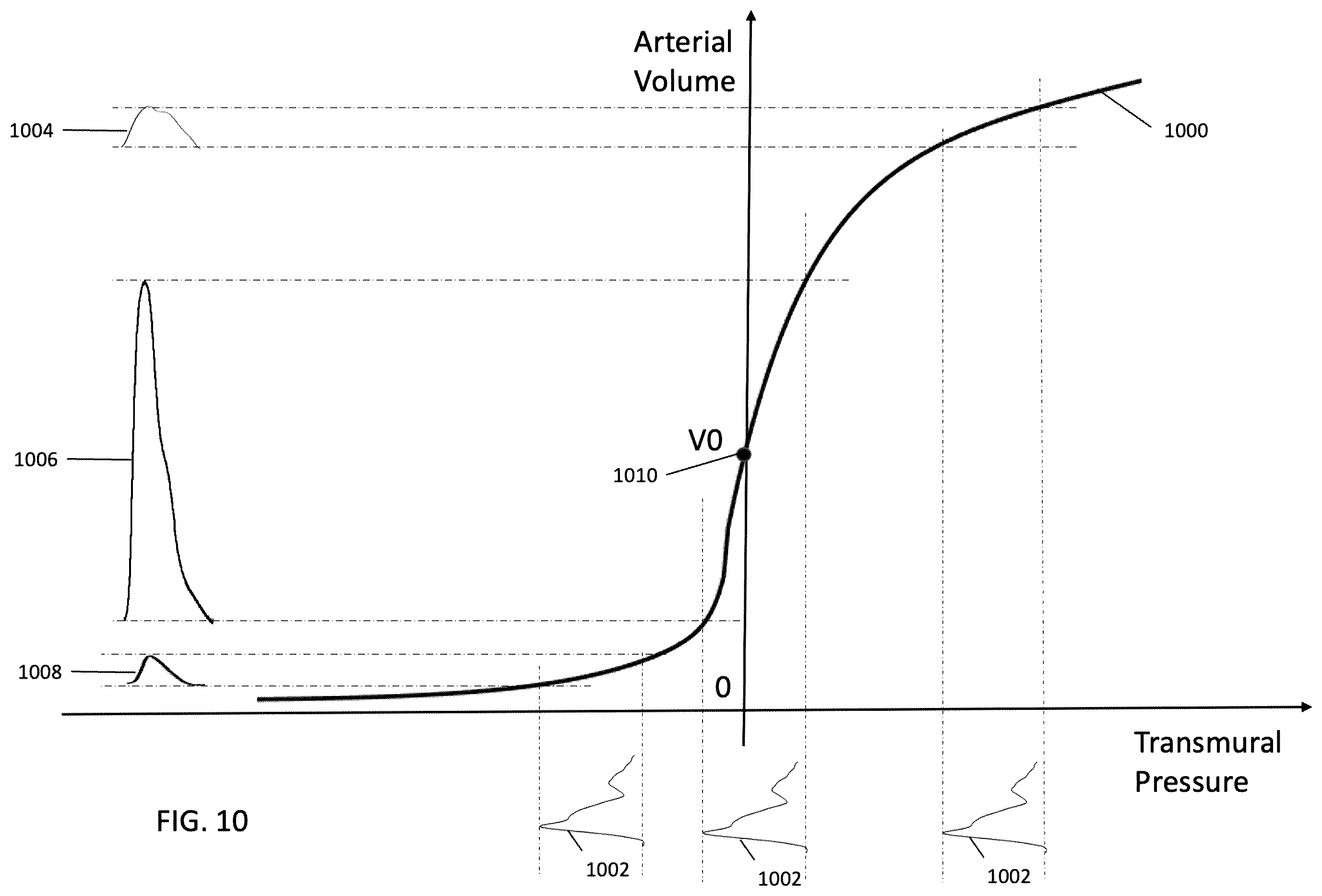 Patent US12350025 Figure 12 – Optical-based oscillometry blood pressure measurement device