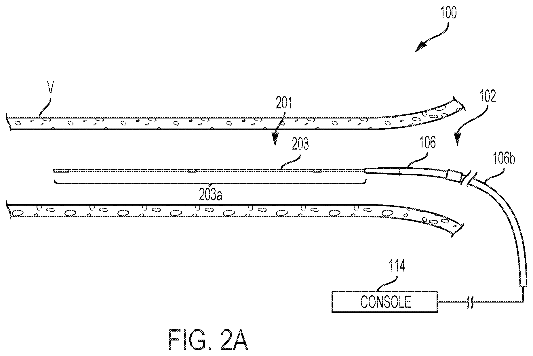 Patent US12350028 Figure 2 – Systems and methods for assessing efficacy of renal neuromodulation therapy