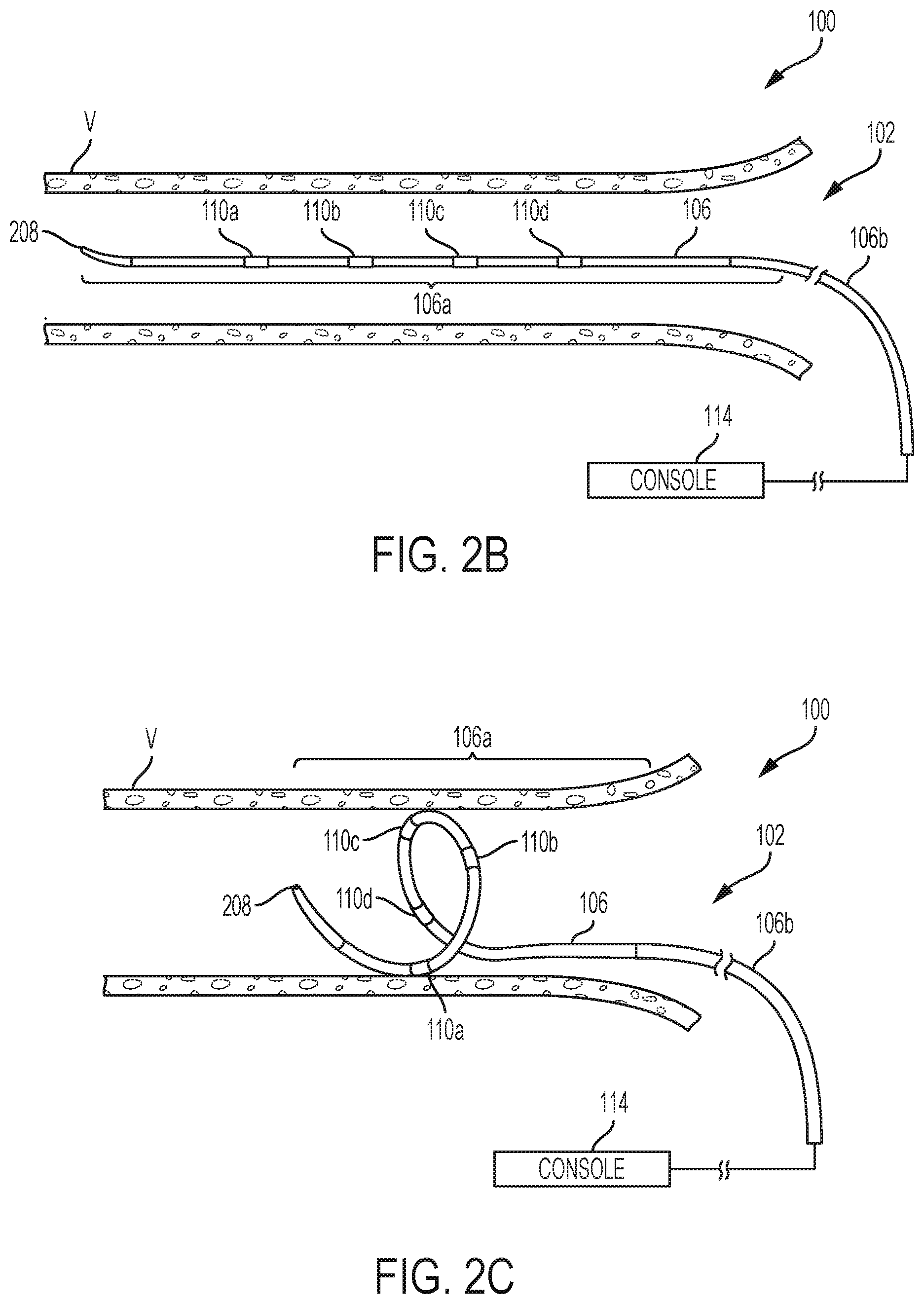 Patent US12350028 Figure 3 – Systems and methods for assessing efficacy of renal neuromodulation therapy