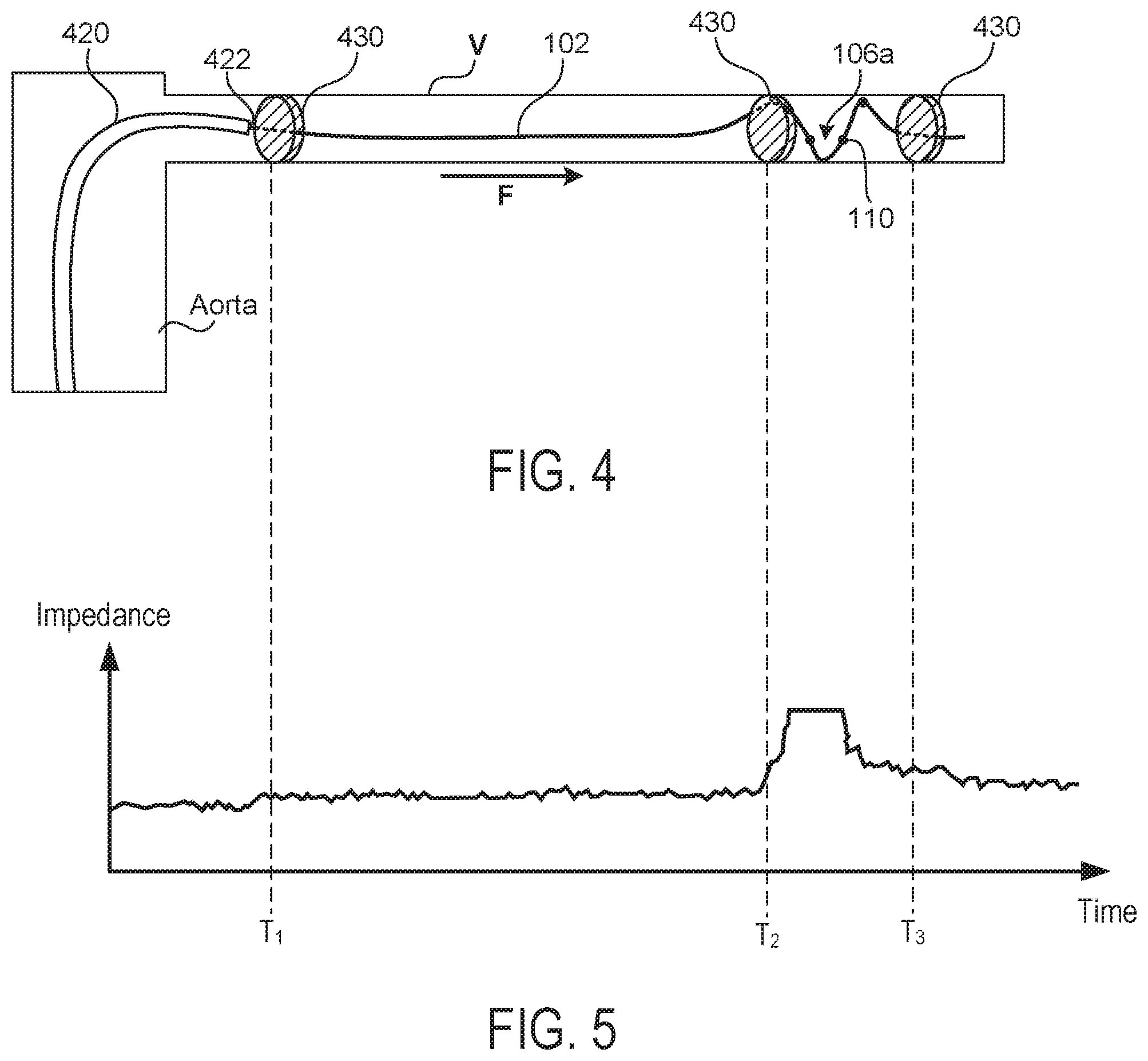 Patent US12350028 Figure 5 – Systems and methods for assessing efficacy of renal neuromodulation therapy
