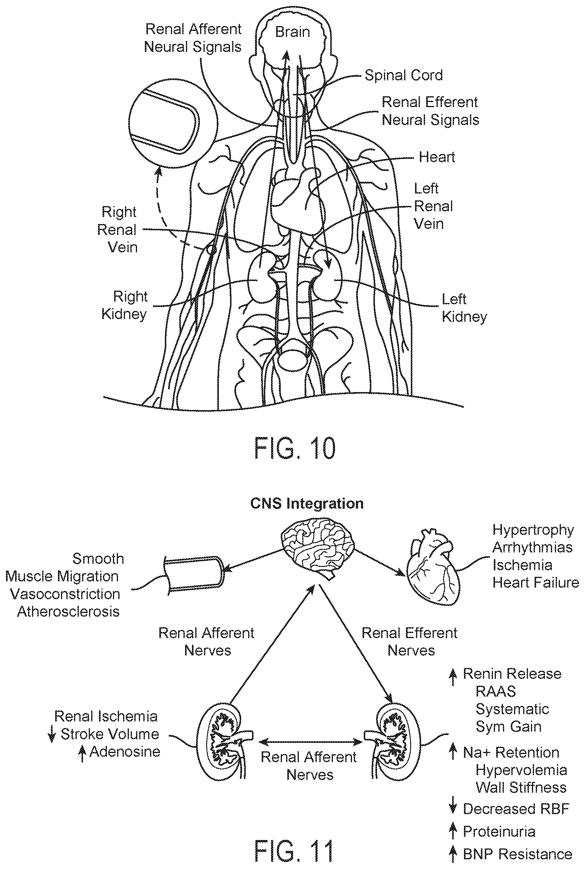Patent US12350028 Figure 10 – Systems and methods for assessing efficacy of renal neuromodulation therapy