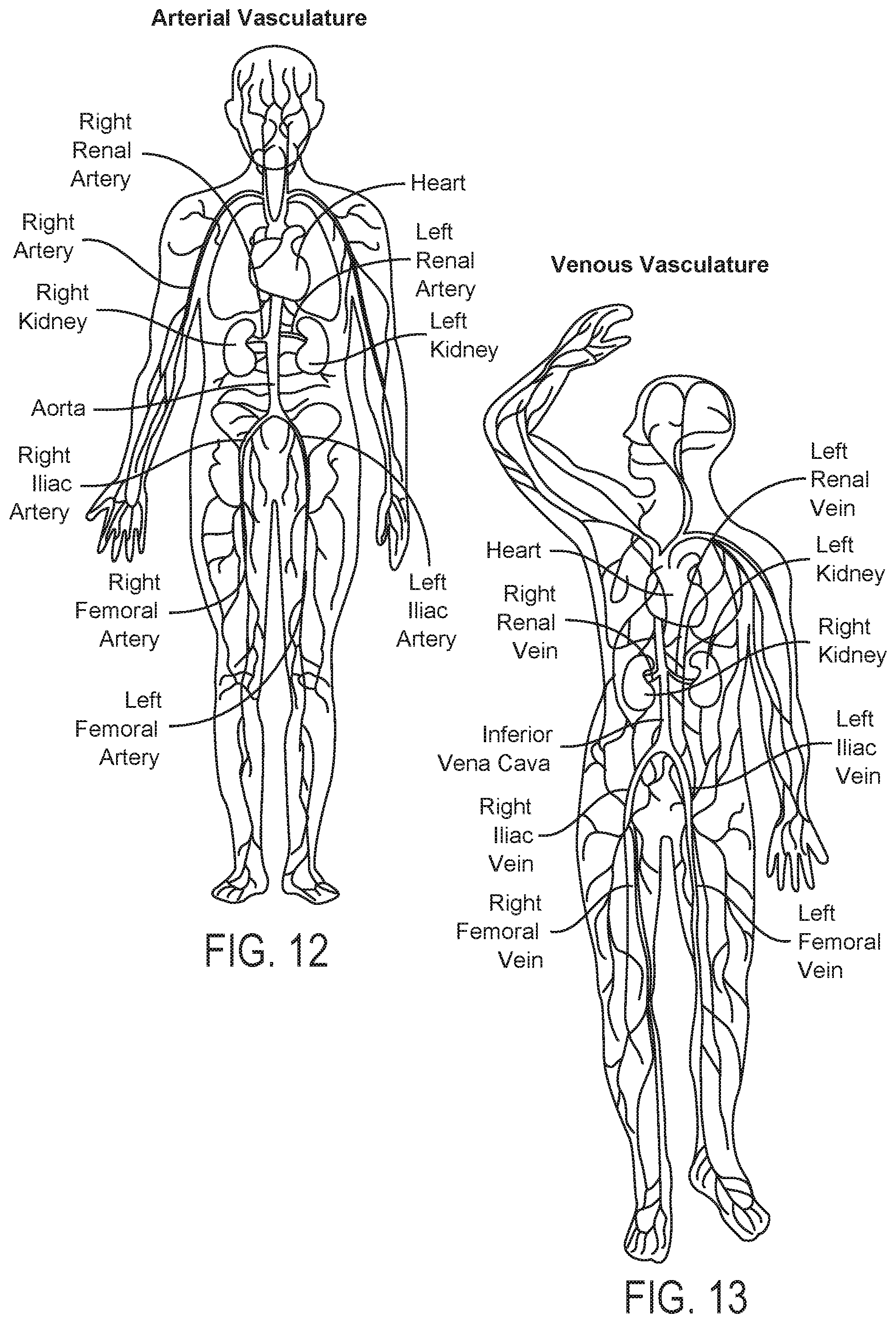 Patent US12350028 Figure 11 – Systems and methods for assessing efficacy of renal neuromodulation therapy