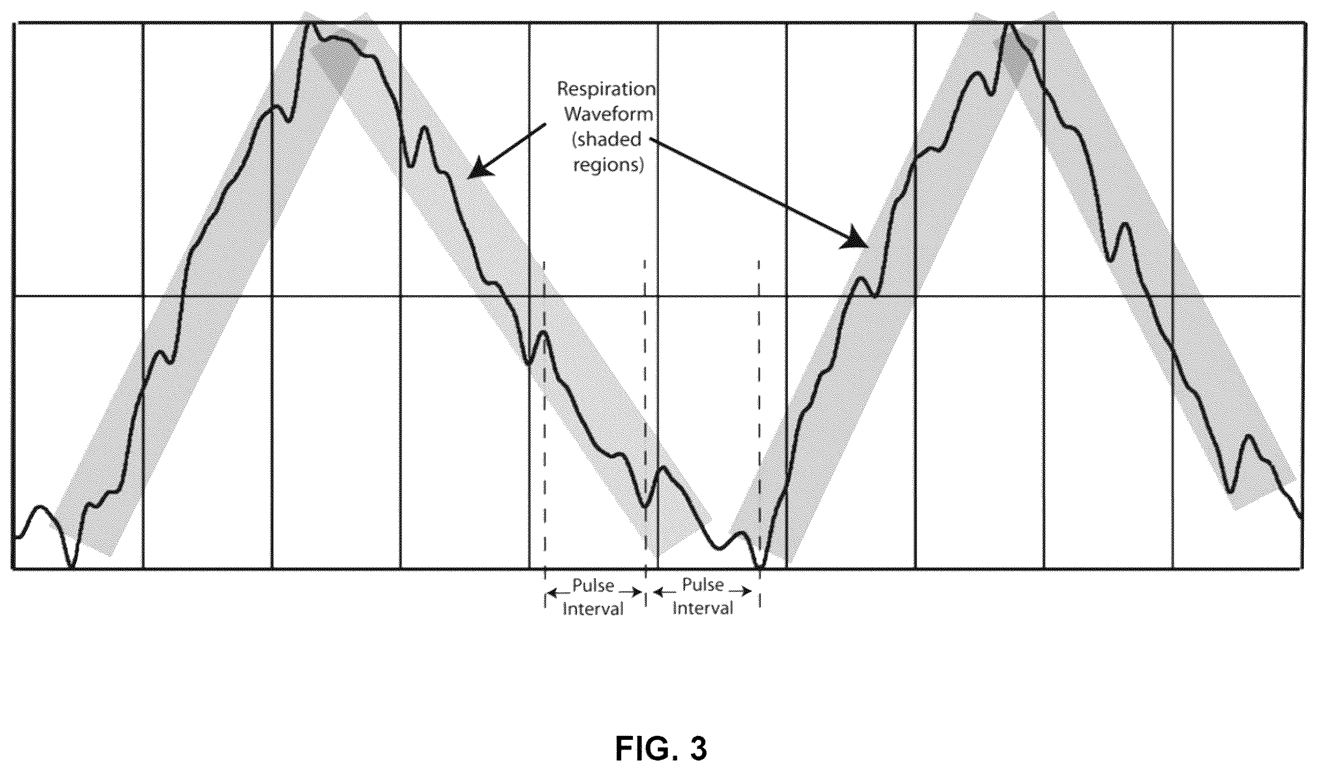 Patent US12350029 Figure 3 – Computation of parameters of a body using an electric field