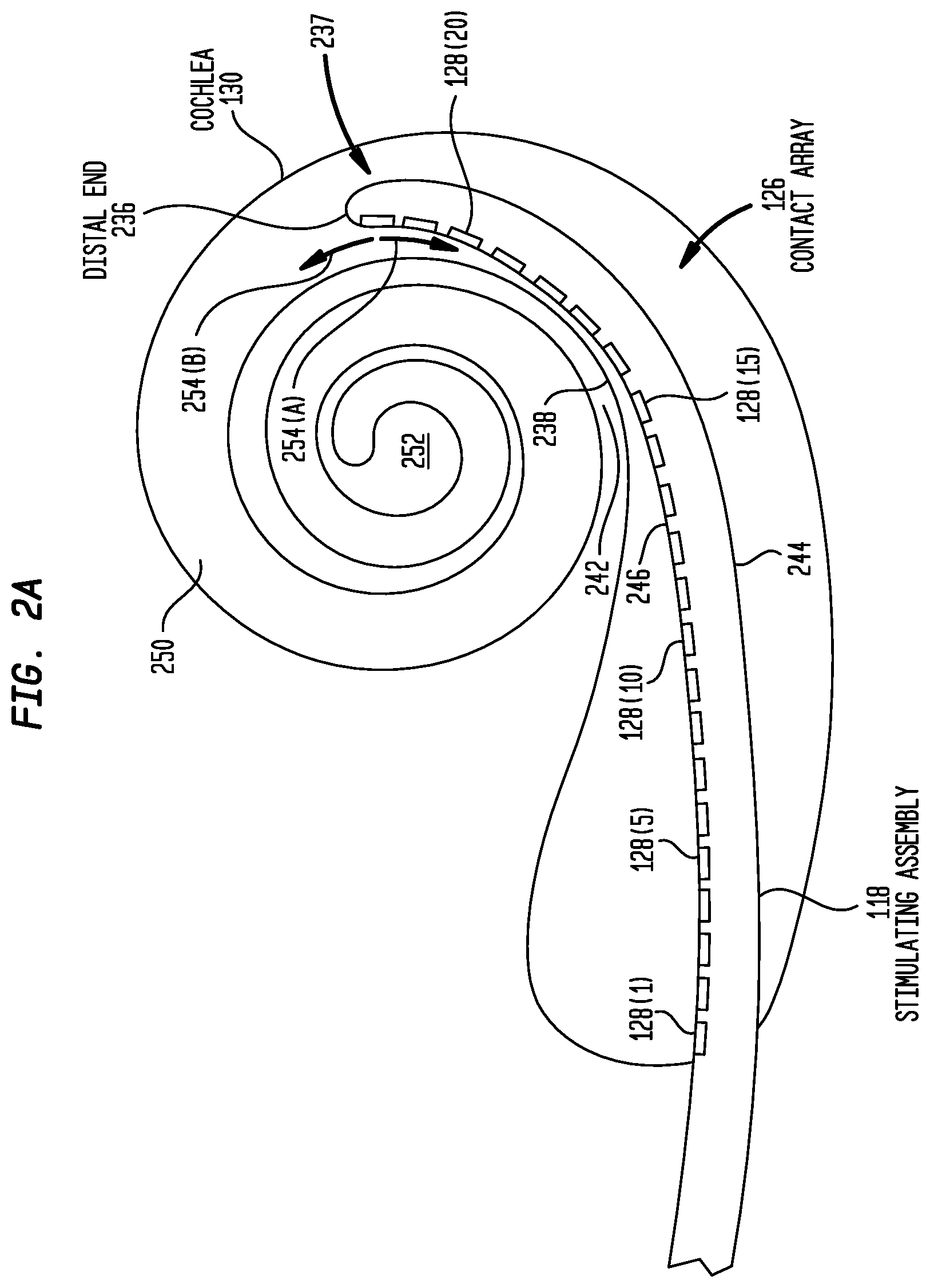 Patent US12350030 Figure 2 – Event detection in an implantable auditory prosthesis