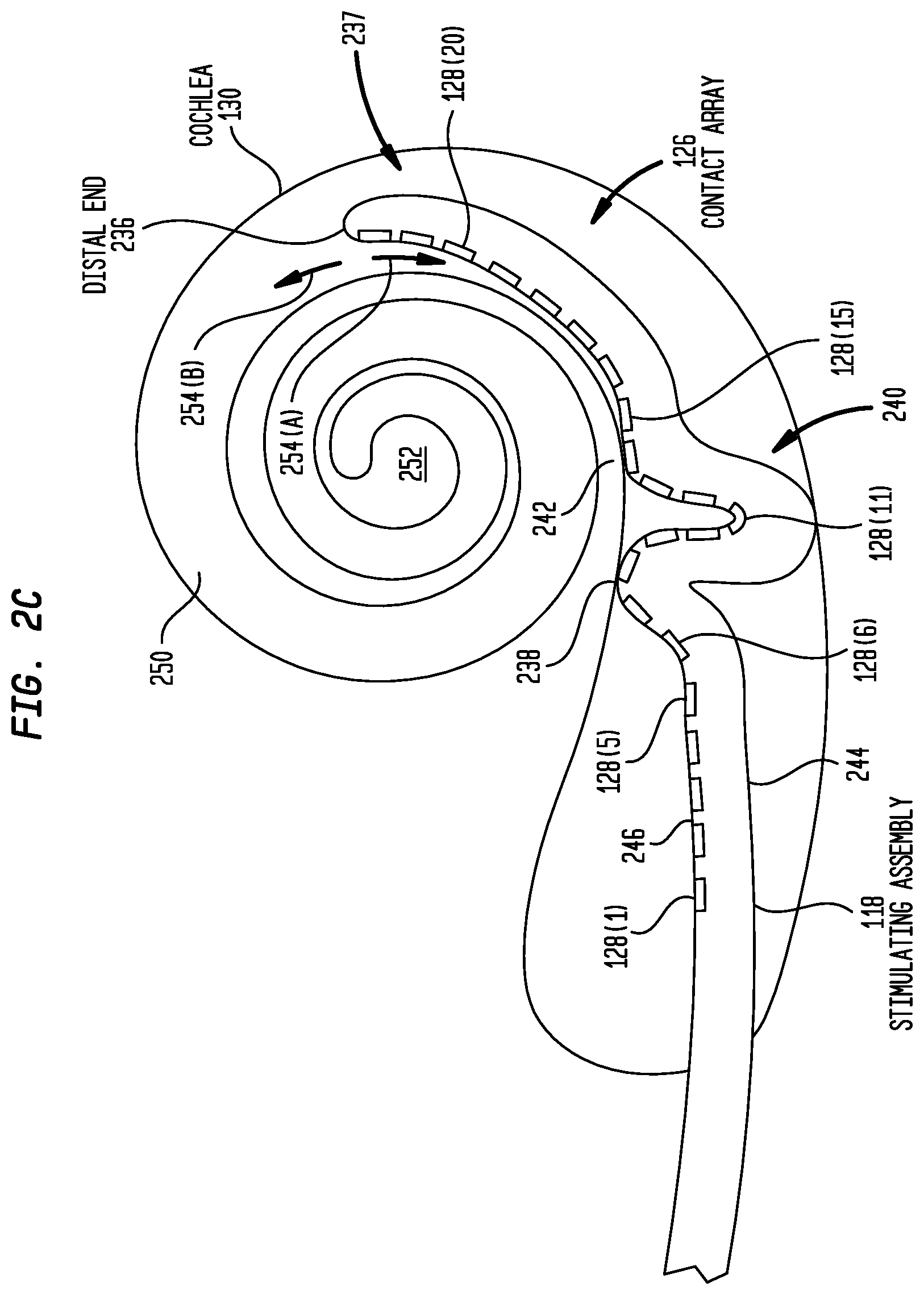 Patent US12350030 Figure 4 – Event detection in an implantable auditory prosthesis