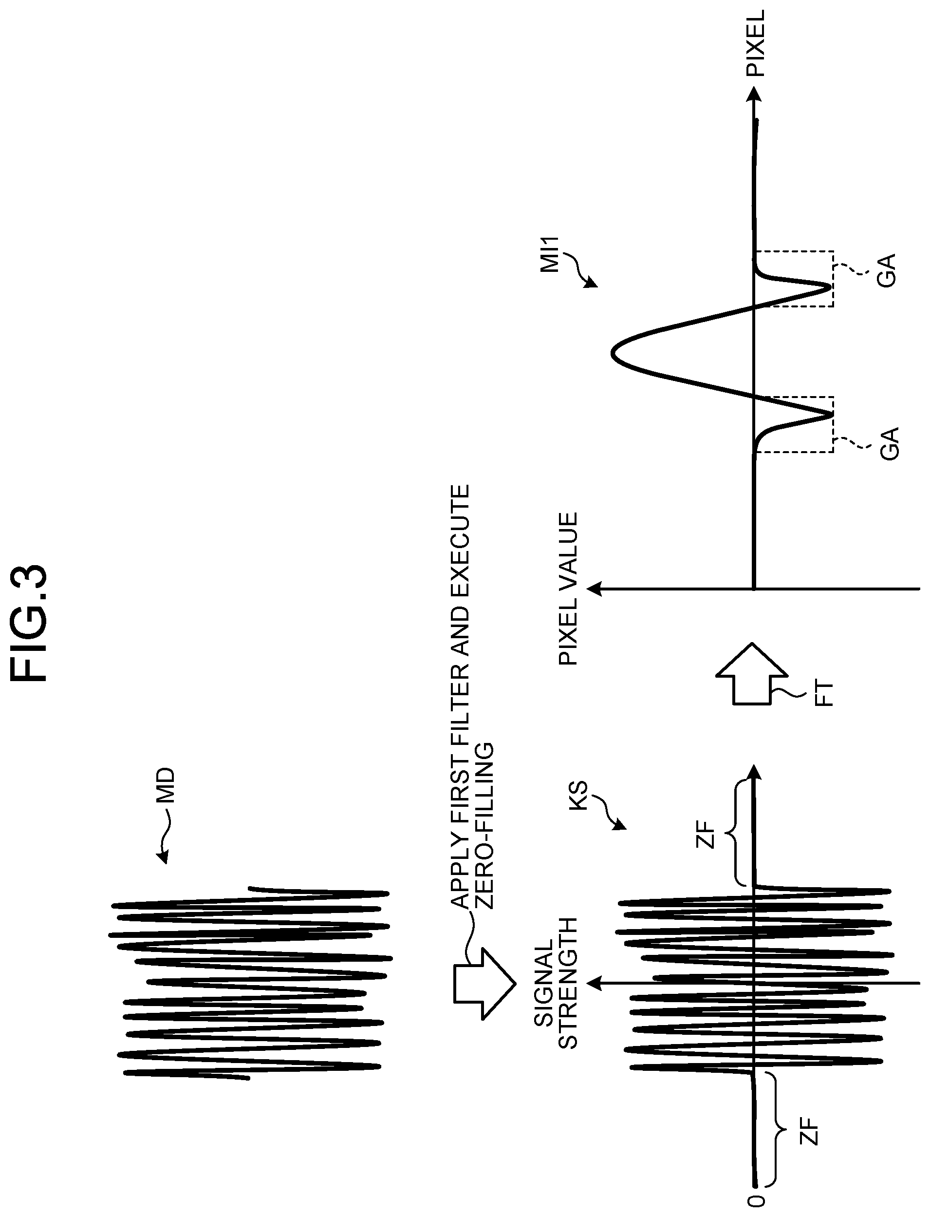 Patent US12350032 Figure 3 – Medical image processing apparatus, method of medical image processing, and nonvolatile computer readable storage medium storing therein medical image processing program