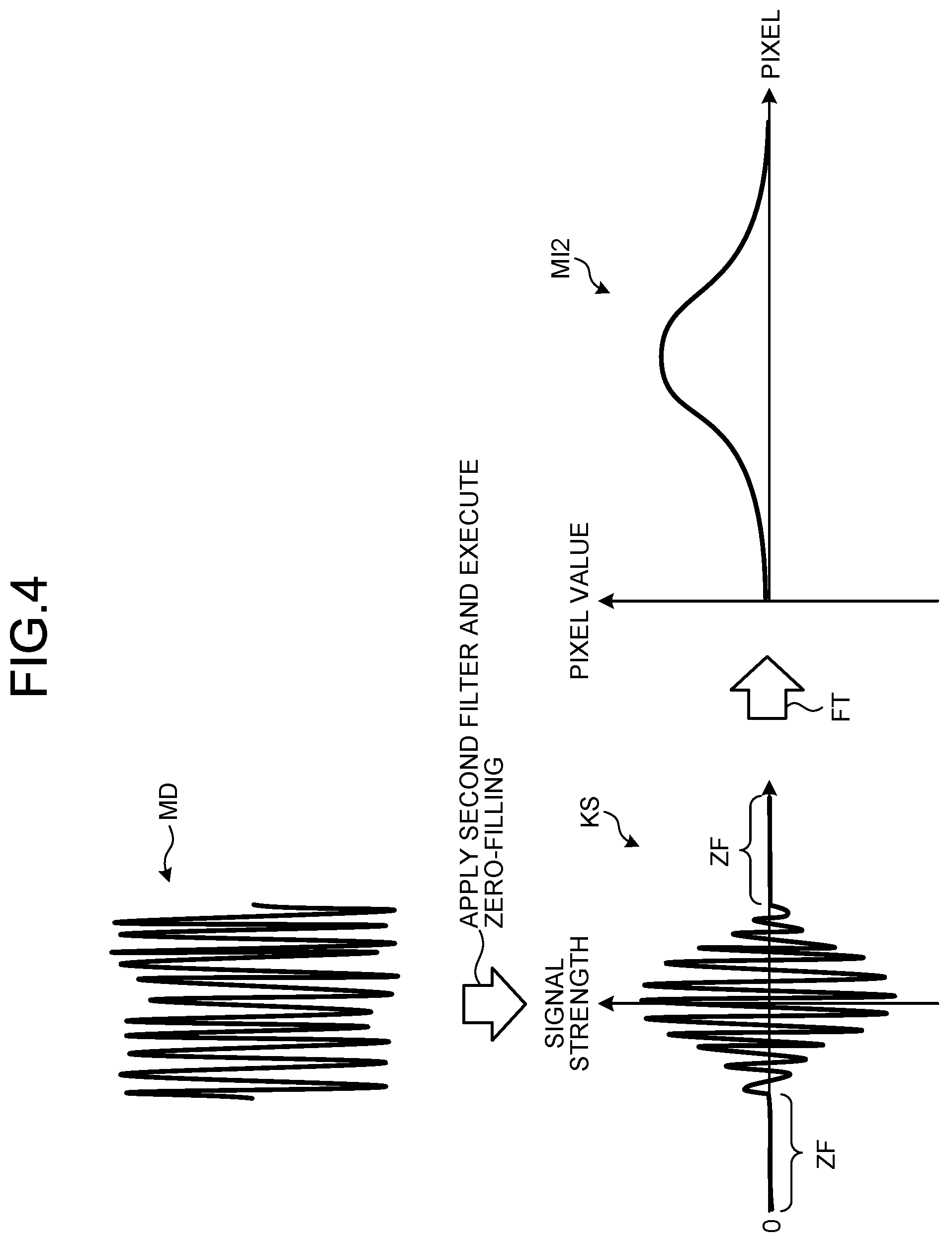 Patent US12350032 Figure 4 – Medical image processing apparatus, method of medical image processing, and nonvolatile computer readable storage medium storing therein medical image processing program