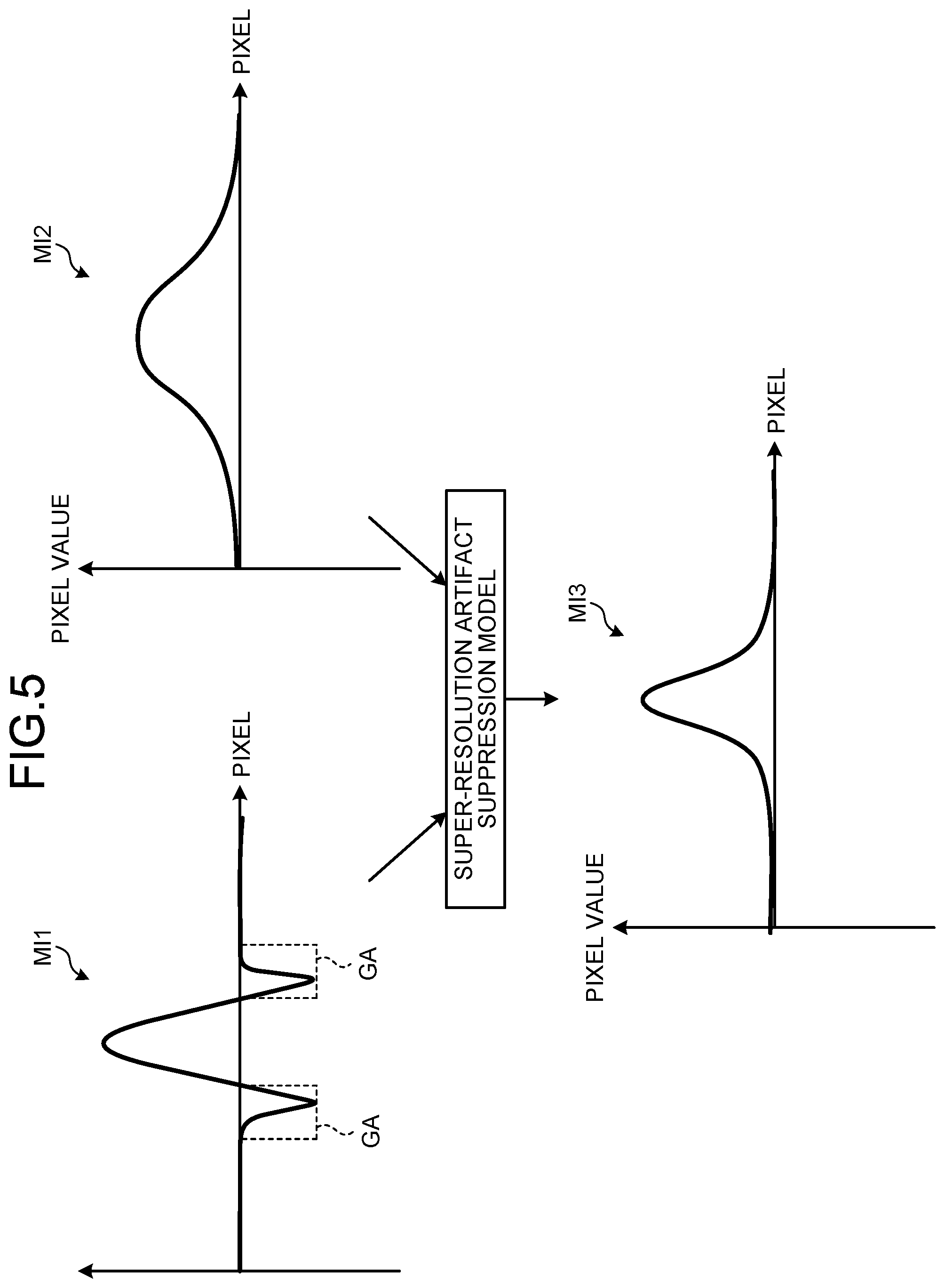 Patent US12350032 Figure 5 – Medical image processing apparatus, method of medical image processing, and nonvolatile computer readable storage medium storing therein medical image processing program
