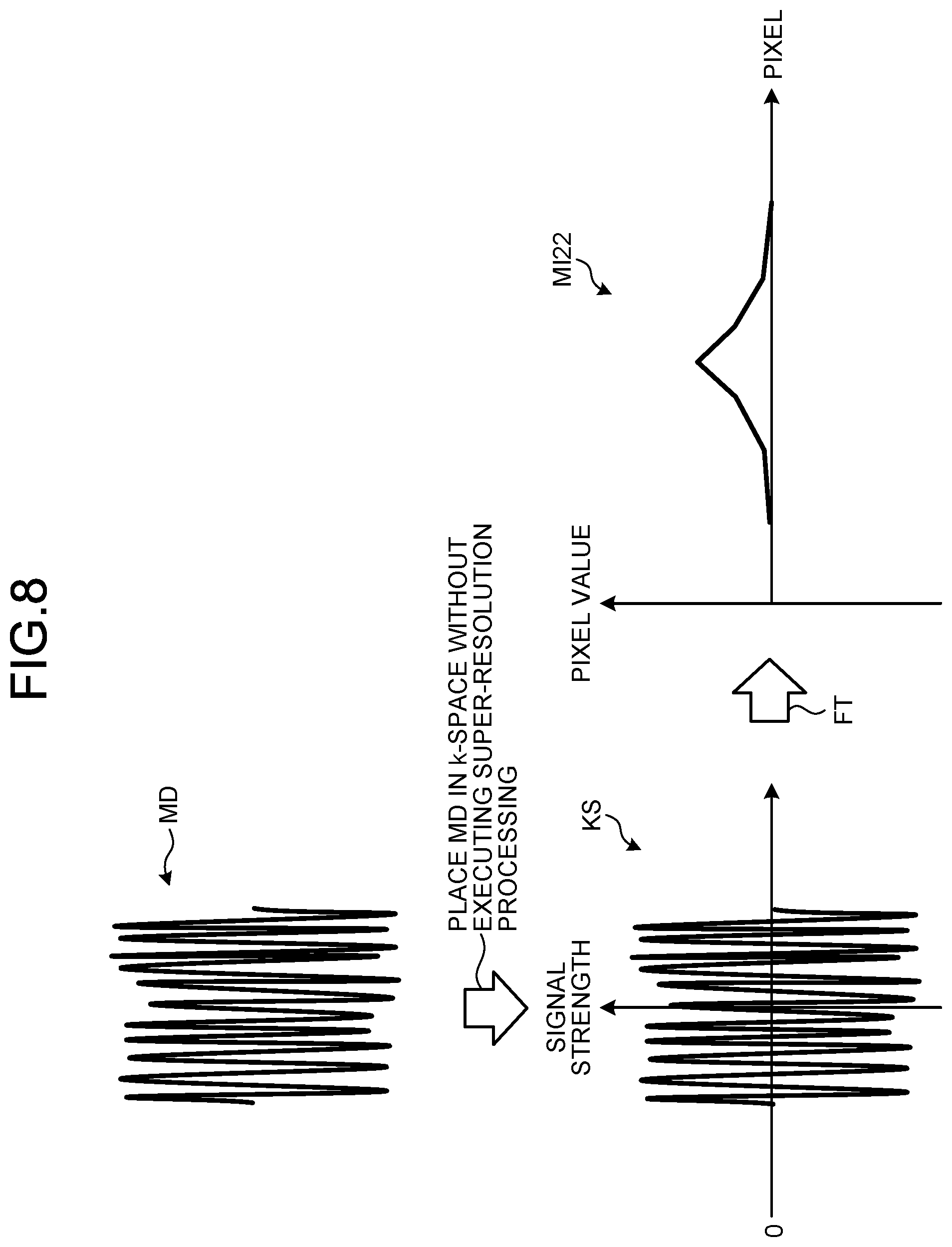 Patent US12350032 Figure 8 – Medical image processing apparatus, method of medical image processing, and nonvolatile computer readable storage medium storing therein medical image processing program