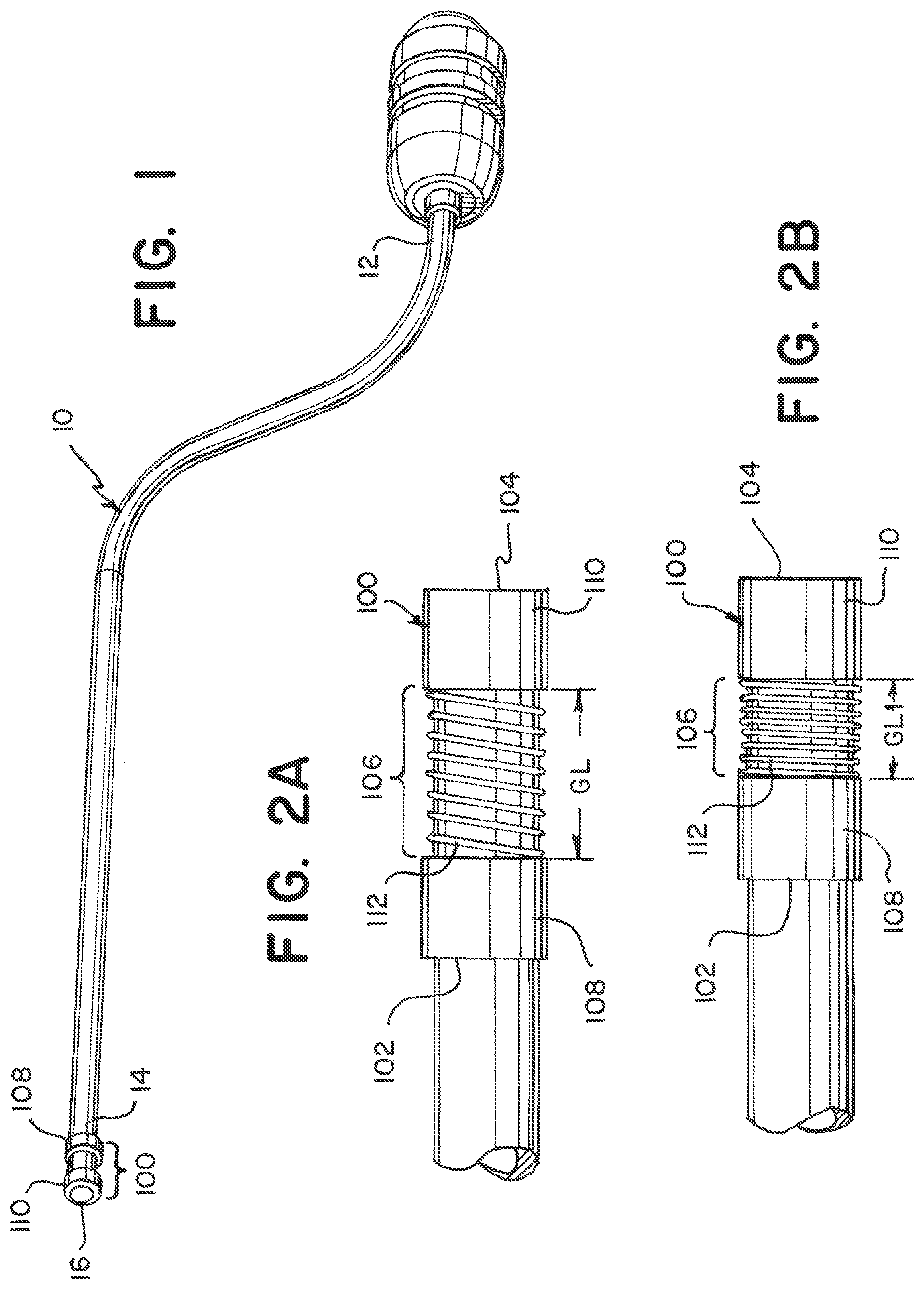 Patent US12350033 Figure 1 – Device and method to detect and remove blood clots for treatment of ischemic stroke using force and electromagnetic sensing