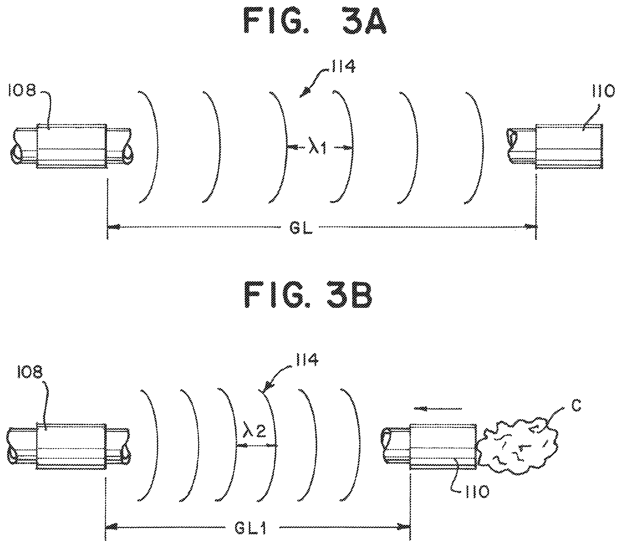 Patent US12350033 Figure 2 – Device and method to detect and remove blood clots for treatment of ischemic stroke using force and electromagnetic sensing