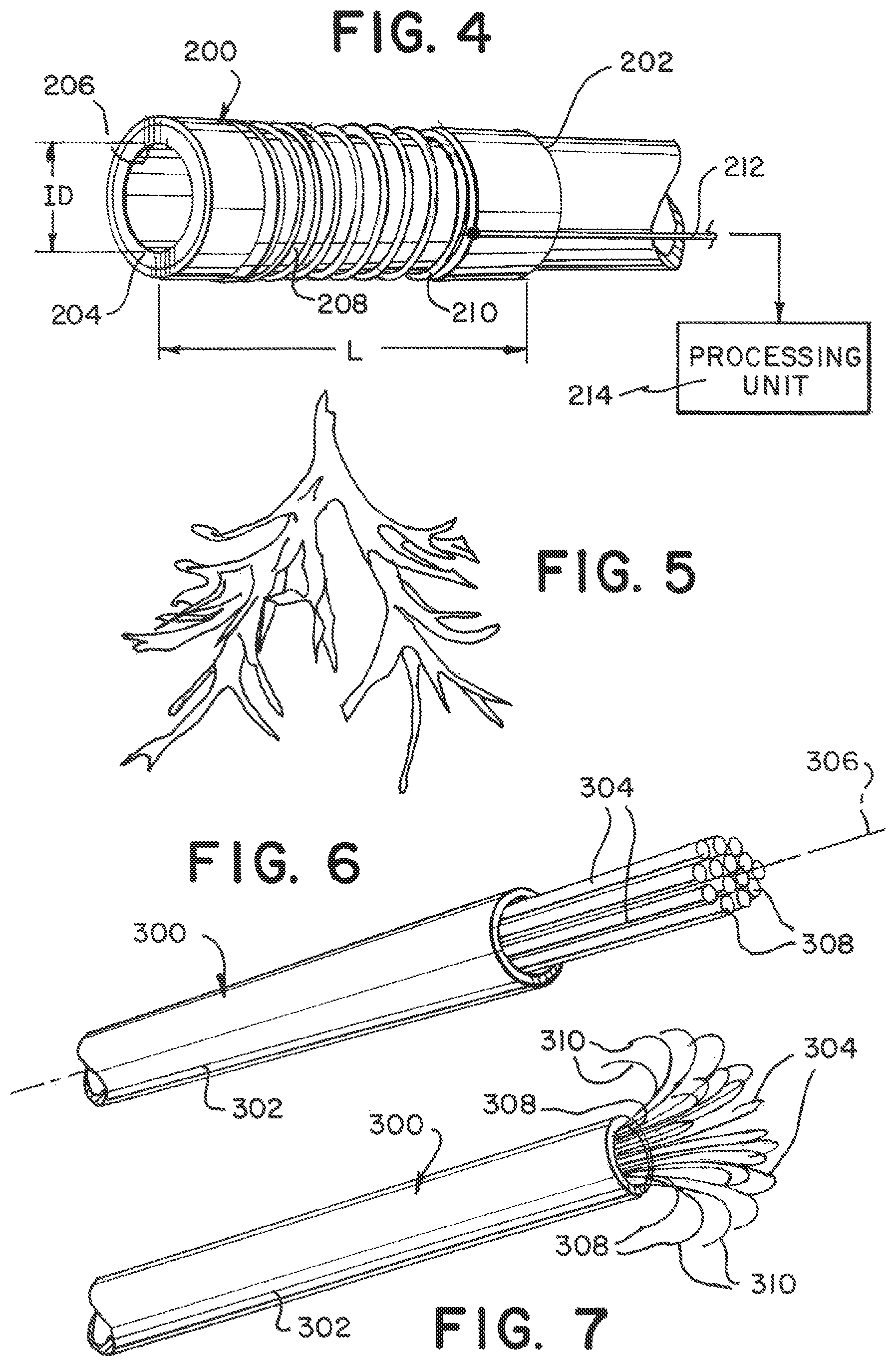 Patent US12350033 Figure 3 – Device and method to detect and remove blood clots for treatment of ischemic stroke using force and electromagnetic sensing