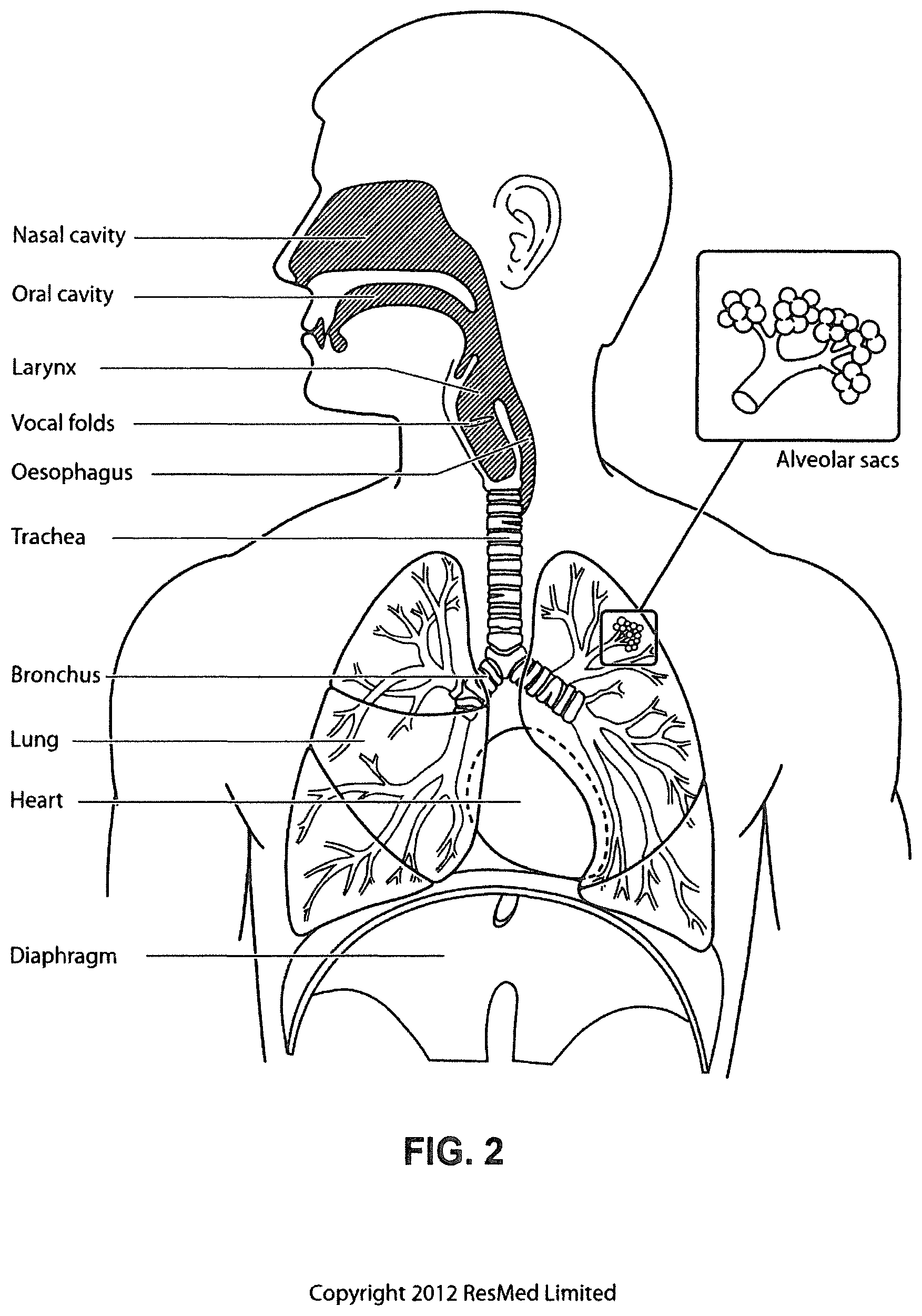 Patent US12350034 Figure 2 – Methods and apparatus for detection of disordered breathing